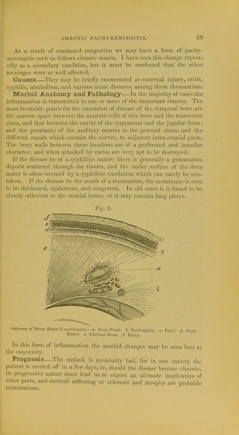 As a result of c-ontiiiiicHl congestion we may liave a form of ]-)acliy- nieniiigitis sueli lis follows chronic mania. I have seen tliis change rejicat- edlv lis a seconilary condition, but it must be confessed that the other meninges were as well affected. Causes.—They may bo brietiy enumerated as external injury, otitis, >\ [iliilis. alcoiiolism, and various acute diseases, among them rheumatism. Morbid Anatomy and Pathology.—In the majority of cases the intiammation is transmitted to one or more of the important sinuses. The most favorable points for the extension of disease of the temporal bone are the narrow space between the mastoid cells of this bone and the transverse sinus, and that between the cavity of the tympanum and the jugulai* fossa; and the proximity of the auditory meatus to the petrosal sinus, and the different cauiUs which contain the nerves, to adjacent intra-cranial parts. The bony walls between these locations are of a perforated and lamellar character, and when attacked by cai'ies are very apt to be destroyed. If the disease be of a syphilitic nature there is generally a gummatous deposit scattered through the tissues, and the under surface of the dura mater is often covered by a syphilitic exudation which can rarely be mis- taken. If the disease be the result of a traumatism, the membrane is seen to be thickened, opalescent, and congested. In old cases it is found to be closely adherent to the cranial bones, or it may contain long plates. Fig. 9. 0*<«>7nao/2>«ra 3fa/«r (Lanccreaax).—a. Bony Plate. &. Perforation, c. Falx. d. Dura Slater, e. Parietal Bone. /. Scalp. In this form of inflammation the morbid changes may be seen best at the convexity. Prognosis—The outlook is invariably bad, for in one variety tlie patient is carried off in a few day.s, or, should the disease become chronic, its progre.ssive nature mu.st lead us to expect an idlimate implication of other parts, and cortical softening or sclerosis and atrophy are probable terminations.