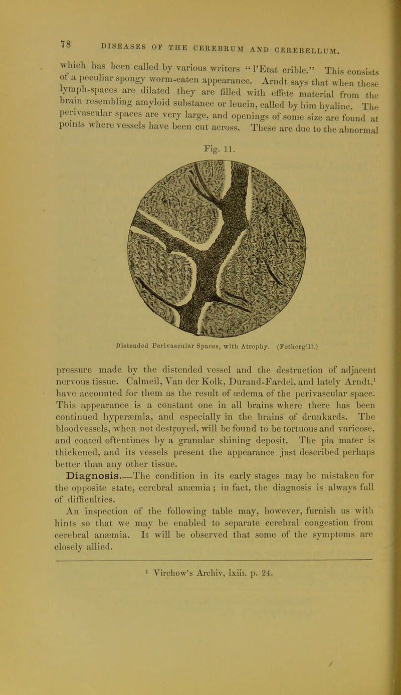 winch lias been called by various writers  I'Etut cri))le. Tliis consists of a peculiar spongy worm-eaten appearance. Arndt says that when these ymph-spaces are dilated they are iilled with effete material from the brain resembling amyloid substance or leucin, called by him hyaline. The perivascular spaces are very large, and openings of some size are found at points where vessels have been cut across. These are due to the abnormal Fiff. 11. Distended Perivascular Spaces, witli Atropliy. (Fothergill.) pressure made by the distended vessel and the destruction of adjacent nervous tissue. Calmeil, Van der Kolk, Durand-Fardel, and lately Arndt.^ have accounted for them as the result of oedema of the perivascular space. This appearance is a constant one in all brains where there has been continued hyperajmia, and especially in the brains of drunkards. The bloodvessels, when not destroyed, will be found to be tortuous and varicose, and coated oftentimes by a granular shining deposit. The pia mater is thickened, and its vessels present the appearance just described perhaps better than any other tissue. Diagnosis The condition in its early stages may be mistaken for the op[)osite state, cerebral ana?mia ; in fact, the diagnosis is always full of difficulties. An inspection of the following table may, however, furnish us with hints so that we may be enabled to separate cerebral congestion from cerebral anajmia. It will be observed that some of the symjitoms are closely allied. Virchow's Arehiv, Ixiii. p. 24.