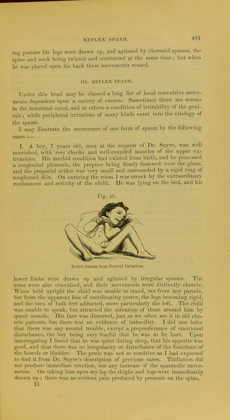 REFr-EX SPASM. ing posture his legs were drawn up, aud agitated by choreoid spasms, the, spine and neck being twisted and contracted at the same time ; but when he was phiced upon his back tiiese movements censed. III. REFLEX SPASM. Under this head may be chissed a long list of local convulsive move- ments dependent \ipon a variety of causes. Sometimes there are worms in the intestinal canal, and at others a condition of irritability of the geni- tals ; while peripheral irritations of many kinds enter into tlic etiology of the spstsm. I may illustrate the occurrence of one form of spasm by the following cases :— I. A boy, 7 years old, seen at the request of Dr. Sayre, was well nourished, with rosy cheeks and well-rounded muscles of the upper ex- tremities. His morbid condition had existed from birth, and he possessed a congenital phimosis, the prepuce being firmly fastened over the glans, and the preputial orifice was very small and surrounded by a rigid ring of toughened skin. On entering the room I was struck by the extraordinary restlessness and activity of the child. He was lying on the bed, and his Fig. 53. Reflex Spasm from Genital Irritation. lower limbs were drawn up and agitated by irregular spasms. The arms were also convulsed, and their movements were distinctly choreic. TN'lien held upright the child was unable to stand, not from any paresis, but from the ai)jiarent loss of coordinating power, the legs becoming rigid, and the toes of both feet adducted, more particularly the left. The child was unable to speak, but attracted the attention of those around him by queer sounds. His face was distorted, just as we often see it in old cho- reic patients, but there was no evidence of imbecility. I did not infer that there was any mental trouble, except a preponderance of emotional disturbance, the boy Ijeing very feai-ful that he was to be hurt. Upon interrogating I found that he was (juiet during sleep, that his ai)petitewas good, and tliat there was no irregidarity or disturbance of the functions of tlie bowels or l)]adder. The pwiis was not so sensitive as I had cxjiected to find it from Dr. Sayre's description of ])revious cases. Titillation did not produce immediate erection, nor any increase of the spasmodic move- ments. On taking him upon my lap the thighs and legs were innnediately drawn up ; there was no evident pain produced by pressure on tiie spine. 31