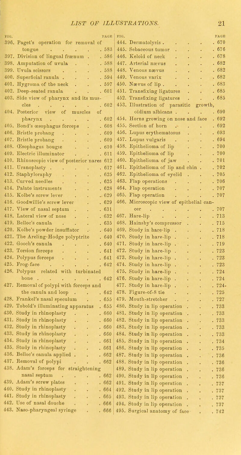 Fin. ['A (IE Fin. PAOE 396. Paget's operation for removal of 444. Dermatolysis • • . . . 670 tongue , 583 445. Sebaceous tumor . . . . 676 397. Division of lingual frajnum . 586 446. Keloid of neck . . . . 678 398. Amputation of uvula 588 447. Arterial na^vus . • . . 682 399. Uvula scissors . 588 448. Venous nsevus . 682 400. Superficial ranula . 594 449. Venous varix . 682 401. Hygroma of the neck 597 450. Ncevus of lip . • • . . 683 402. Deep-seated ranula 601 451. Transfixing ligatures . . 685 403. Side view of pharynx and its mus- 452. Transfixing ligatures 685 cles 602 453. Illustration of parasitic growth, 404. Posterior view of muscles of o'idium albicans . 690 pharynx 602 454. Horns growing on nose and face 692 405. Bond's oesophagus forceps 608 455. Section of horn . . • . 692 406. Bristle probang . 609 456. Lupus erythematosus 693 407. Bristle probang . 609 457. Lupus vulgaris . . . . 694 40S. (Esophagus bougie 610 458. Epithelioma of lip . . . 700 409. Electric illuminator 611 459. Epithelioma of lip . . . 700 410. Rhinoscopie view of posterior nares 612 460. Epithelioma of jaw 701 411. Uranoplasty 617 461. Epithelioma of lip and chin . 702 412. Staphyloraphy . . . . 625 462. Epithelioma of eyelid 705 413. Curved needles . 625 463. Flap operations . . . . 706 414. Palate instruments 628 464. Flap operation • 707 415. Kolbe's screw lever 629 465. Flap operation . . . . 707 416. Goodwillie's screw lever 629 466. Microscopic view of epithelial can- 417. View of nasal septum . 631 cer ...... 707 418. Lateral view of nose 632 467. Hare-lip 713 419. Belloc's canula . 635 468. Hainsby's compressor 715 420. Kolbe's powder insufflator 640 469. Study in hare-lip . 718 421. The Areling-Hodge polyptrite 640 470. Study in hare-lip . . . . 718 422. Gooch's canula . 640 471. Study in hare-lip . . . . 719 423. Torsion forceps . 641 472. Study in hare-lip . . . . 723 424. Polypus forceps .... 641 473. Study in hare-lip . . . . 723 425. Frog-face 642 474. Study in hare-lip . . . . 723 426. Polypus related with turbinated 475. Study in hare-lip . . . . 724 bone ...... 642 476. Study in hare-lip . . . . 724 427. Removal of polypi with forceps and 477. Study in hare-lip . . . . 724- the canula and loop 642 478. Figure-of-8 tie ... 725 428. Frankel's nasal speculum 655 479. Mouth-stretcher . 727 429. Tobold's illuminating apparatus . 655 480. Study in lip operation . 733 430. Study in rhinoplasty 660 481. Study in lip operation . 733 431. Study in rhinoplasty 660 482. Study in lip operation . . . 733 432. Study in rhinoplasty 660 483. Study in lip operation . 733 433. Study in rhinoplasty 660 484. Study in lip operation . 733 434. Study in rhinoplasty 661 485. Study in lip operation . 734 435. Study in rhinoplasty 661 486. Study in lip operation . . . 735 436. Belloc's canula applied . 662 487. Study in lip operation . 736 437. Removal of polypi 662 488. Study in lip operation . . . 736 438. Adam's forceps for straightening 489. Study in lip operation . . , 736 nasal septum .... 662 490. Study in lip operation . 736 439. Adam's screw plates . 662 491. Study in lip operation . 737 440. Study in rhinoplasty 664 492. Study in lip operation . 737 441. Study in rhinoplasty 665 493. Study in lip operation . 737 442. Use of nasal douche 666 494. Study in lip operation . 737 443. Naso-pharyngeal syringe . 666 495. Surgical anatomy of face 742