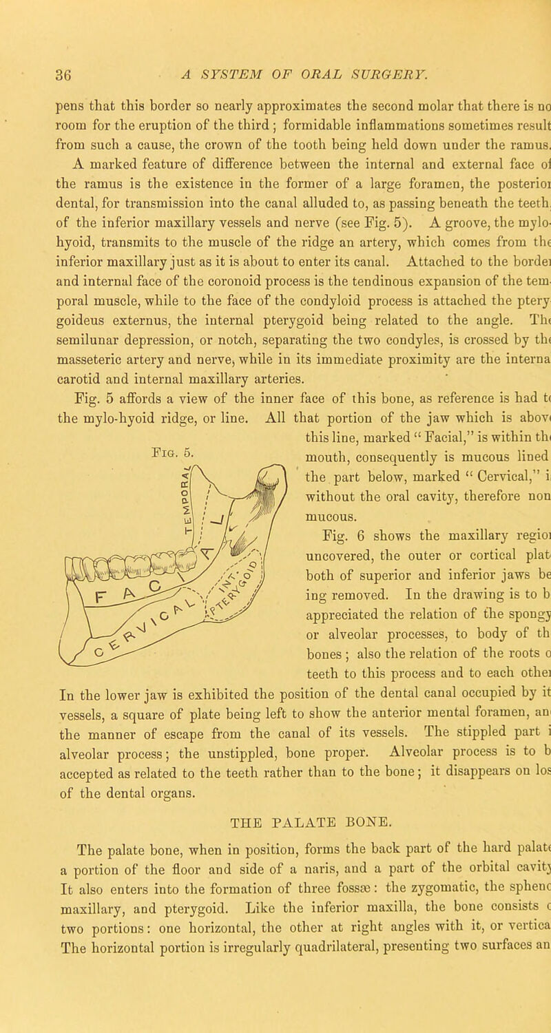 pens that this border so nearly approximates the second molar that there is no room for the eruption of the third ; formidable inflammations sometimes result from such a cause, the crown of the tooth being held down under the ramus, A marked feature of difference between the internal and external face ol the ramus is the existence in the former of a large foramen, the posterior dental, for transmission into the canal alluded to, as passing beneath the teeth of the inferior maxillary vessels and nerve (see Fig. 5). A groove, the mylo- hyoid, transmits to the muscle of the ridge an artery, which comes from tht inferior maxillary just as it is about to enter its canal. Attached to the bordei and internal face of the coronoid process is the tendinous expansion of the tern, poral muscle, while to the face of the condyloid process is attached the ptery goideus externus, the internal pterygoid being related to the angle. Tiu semilunar depression, or notch, separating the two condyles, is crossed by th< masseteric artery and nerve, while in its immediate proximity are the interna carotid and internal maxillary arteries. Fig. 5 affords a view of the inner face of this bone, as reference is had t< the mylo-hyoid ridge, or line. All that portion of the jaw which is abovi this line, marked  Facial, is within thi mouth, consequently is mucous lined the part below, marked  Cervical, i without the oral cavity, therefore non mucous. Fig. 6 shows the maxillary regioi uncovered, the outer or cortical plat both of superior and inferior jaws be ing removed. In the drawing is to b appreciated the relation of the spongy or alveolar processes, to body of th bones ; also the relation of the roots o teeth to this process and to each othei In the lower jaw is exhibited the position of the dental canal occupied by it vessels, a square of plate being left to show the anterior mental foramen, an the manner of escape from the canal of its vessels. The stippled part i alveolar process; the unstippled, bone proper. Alveolar process is to b accepted as related to the teeth rather than to the bone; it disappears on los of the dental organs. THE PALATE BONE. The palate bone, when in position, forms the back part of the hard palat< a portion of the floor and side of a naris, and a part of the orbital cavity It also enters into the formation of three fosste: the zygomatic, the sphenc maxillary, and pterygoid. Like the inferior maxilla, the bone consists c two portions: one horizontal, the other at right angles with it, or vertica The horizontal portion is irregularly quadrilateral, presenting two surfaces an