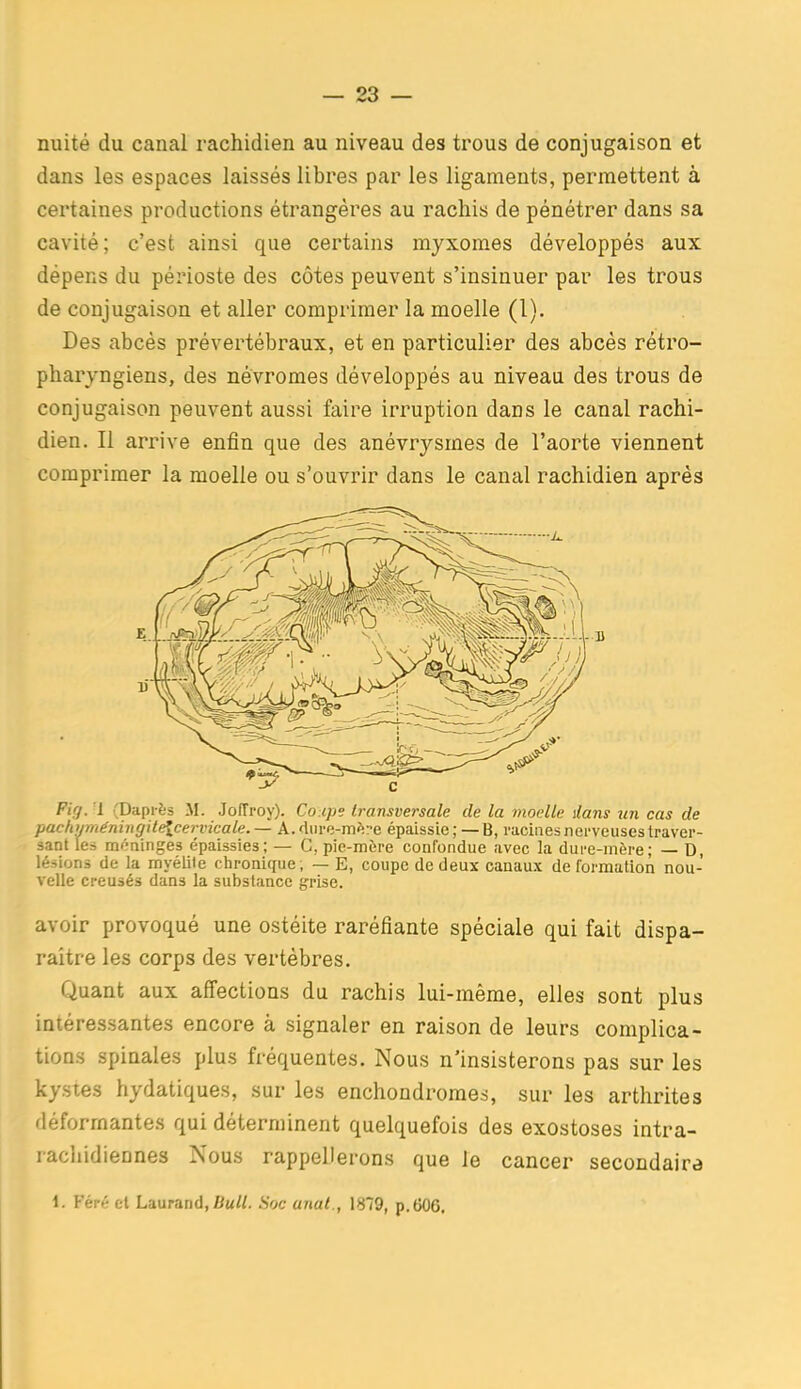 nuité du canal rachidien au niveau des trous de conjugaison et dans les espaces laissés libres par les ligaments, permettent à certaines productions étrangères au rachis de pénétrer dans sa cavité; c'est ainsi que certains myxomes développés aux dépens du périoste des côtes peuvent s'insinuer par les trous de conjugaison et aller comprimer la moelle (1). Des abcès prévertébraux, et en particulier des abcès rétro- pharyngiens, des névromes développés au niveau des trous de conjugaison peuvent aussi faire irruption dans le canal rachi- dien. Il arrive enfin que des anévrysmes de l'aorte viennent comprimer la moelle ou s'ouvrir dans le canal rachidien après Firj. U (Dapi-ès M. JofTroy). Coupe transversale de la moelle dans nn cas de pachmiiéningitélcervicale.— A.fliii'e-mJ::'e épaissie;—B, racinesnei-veusestraver- sant le= méninges épaissies; — C, pie-mère confondue avec la dure-mère; — D, lésions de la myélite chronique; — E, coupe de deux canaux de formation nou- velle creusés dans la substance grise. avoir provoqué une ostéite raréfiante spéciale qui fait dispa- raître les corps des vertèbres. Quant aux affections du rachis lui-même, elles sont plus intéressantes encore à signaler en raison de leurs complica- tions spinales plus fréquentes. Nous n'insisterons pas sur les kystes hydatiques, sur les enchondromes, sur les arthrites déformantes qui déterminent quelquefois des exostoses intra- racliidiennes Nous rappellerons que Je cancer secondaire 1. Féré et Laurand.BM//. Hoc anal., 1879, p.006.