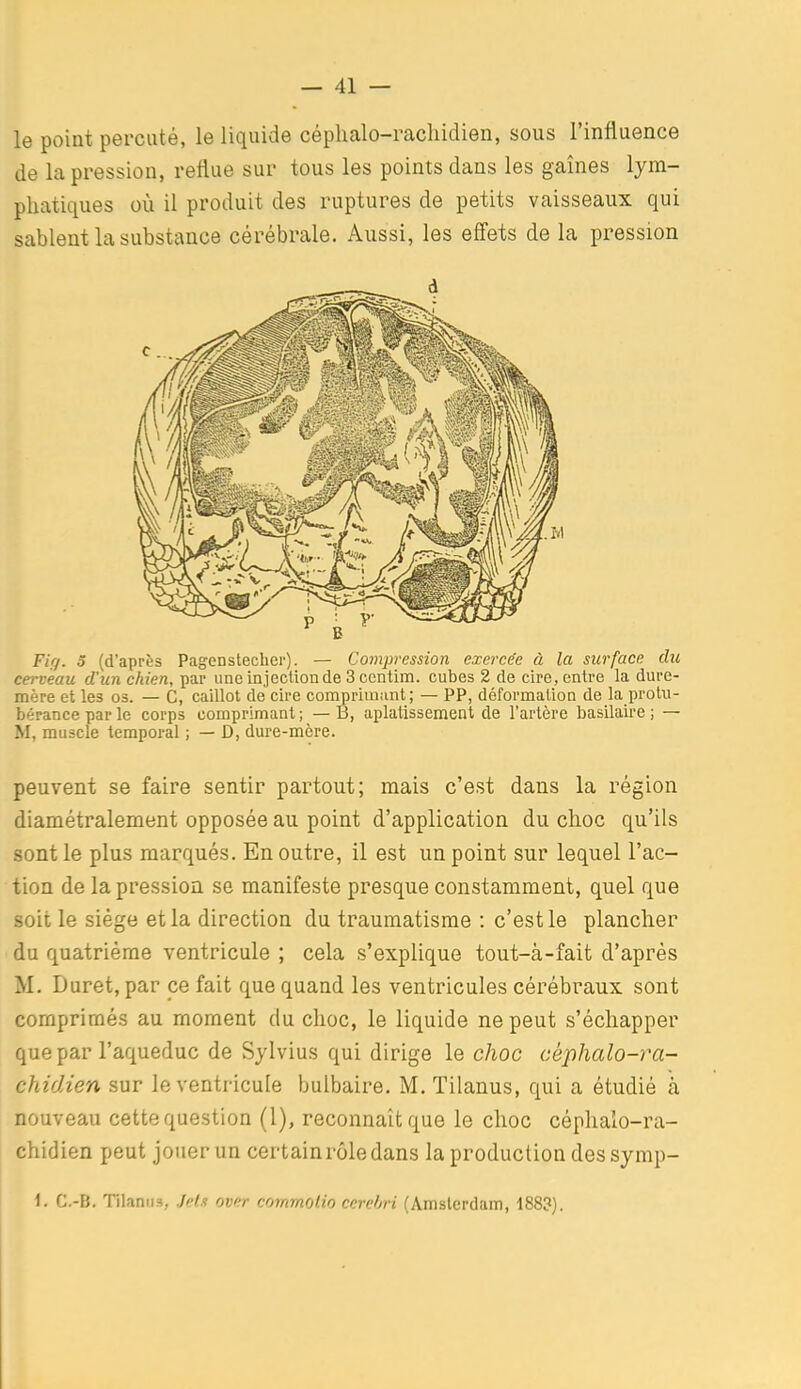 le point percuté, le liquide céphalo-rachidien, sous l'influence de la pression, reflue sur tous les points dans les gaines lym- phatiques où il produit des ruptures de petits vaisseaux qui sablent la substance cérébrale. Aussi, les effets de la pression Fk/. S (d'après Pagenstecher). — Coynpression exercée à la surface du cerveau d'un chien, par une injection de 3 centim. cubes 2 de cire, entre la dure- mère et les 03. — C, caillot de cire comprimant; — PP, déformation de la protu- bérance par le corps comprimant ; — B, aplatissement de l'artère basilaire ; — M, muscle temporal ; — D, dure-mère. peuvent se faire sentir partout; mais c'est dans la région diamétralement opposée au point d'application du choc qu'ils sont le plus marqués. En outre, il est un point sur lequel l'ac- tion de la pression se manifeste presque constamment, quel que soit le siège et la direction du traumatisme : c'est le plancher du quatrième ventricule ; cela s'explique tout-à-fait d'après M. Duret, par ce fait que quand les ventricules cérébraux sont comprimés au moment du choc, le liquide ne peut s'échapper que par l'aqueduc de Sjlvius qui dirige le choc céphalo-ra- chidien sur le ventricule bulbaire. M. Tilanus, qui a étudié à nouveau cette que.stion (1), reconnaît que le choc céphalo-ra- chidien peut jouer un certain rôle dans la production des symp- I. C.-B. Tilanus, Jeta over commotio cerchri (Amsterdam, 1883).