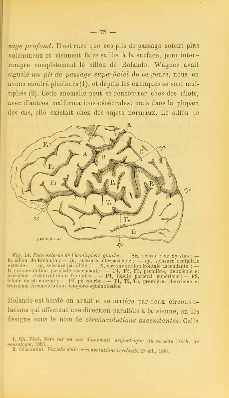 sage profond. Il est rare que ces plis de passage soient plas volumineux et viennent faire saillie à la surface, pour inter- rompre complèleraeut le sillon de Rolando. Wagner avait signalé un i^li de passage superficiel de ce genre, nous en avons montré plusieurs (1), et depuis les exemples se sont mul- tipliés (2). Cette anomalie peut se rencontrer chez des idiots, avec d'autres malformations cérébrales; mais dans la plupart des cas, elle existait chez des sujets normaux. Le sillon de Fiff. 14. Face externe de l'hémisphère, gauche. — SS, scissui-e de Sylvius ; — R, sillon de Rolando;— ip, scissure ititerpariétale ; —op, scissure occipitale externe: — sp, scissure parallèle; — A, circonvolution frontale ascendante ; — B, circonvolution pariétale ascendante ; — Fi, F2, F3, première, deuxième et troisième circonvolutions frontales ; - PI, lobule pariétal supérieur : — P2, lobule du pli courbe ; — P2, pli courbe ; — Tl, T2, T3, première, deuxième et troisième circonvolutions temporo-sphénoïdales. Rolando est bordé en avant et en arriére par deux circonvo- lutions qui affectent une direction parallèle à la sienne, on les désigne sous le nom de circonvolulions ascendantes. Celle \. Ch. Féré. iVo/ç mr un ca.i d'anomali asymétrique du cerveau (Arch. de neurotof/te, iHo.ij. 2. Giacomini. Varieta délie circonvoluzione cereirali, 2« éd. 1884