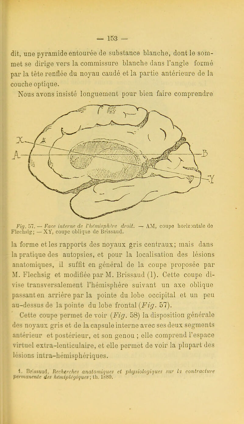 dit, une pyramide entourée de substance blanche, dont le som- met se dirige vers la commissure blanche dans l'angle formé par la tète renflée du noyau caudé et la partie antérieure de la couche optique. Nous avons insisté longuement pour bien faire comprendre Fifj. 57. — Face interne de Vliémixph'-re droit. — AM, coupo horizontale de Flechsig; —XY, coupe oblique de Brissaud. la forme et les rapports des noyaux gris centraux; mais dans a pratique des autopsies, et pour la localisation des lésions anatomiques, il suffît en général de la coupe proposée par M. Flechsig et modifiée par M. Brissaud (1). Cette coupe di- ise transversalement l'hémisphère suivant un axe oblique passant en arriére par la pointe du lobe occipital et un peu au-dessus de la pointe du lobe frontal {Fig. 57). Cette coupe permet de voir {Fig. 58) la disposition générale des noyaux gris et de la capsule interne avec ses deux segments antérieur et postérieur, et son genou ; elle comprend l'espace virtuel extra-lenticulaire, et elle permet de voir la plupart des lésions intra-hémisphériques. i. Brissaud, Renhtrchei analomiques et physiologiques sur il contracture permanente des héjniplt'fjiques ; th. lnHO.