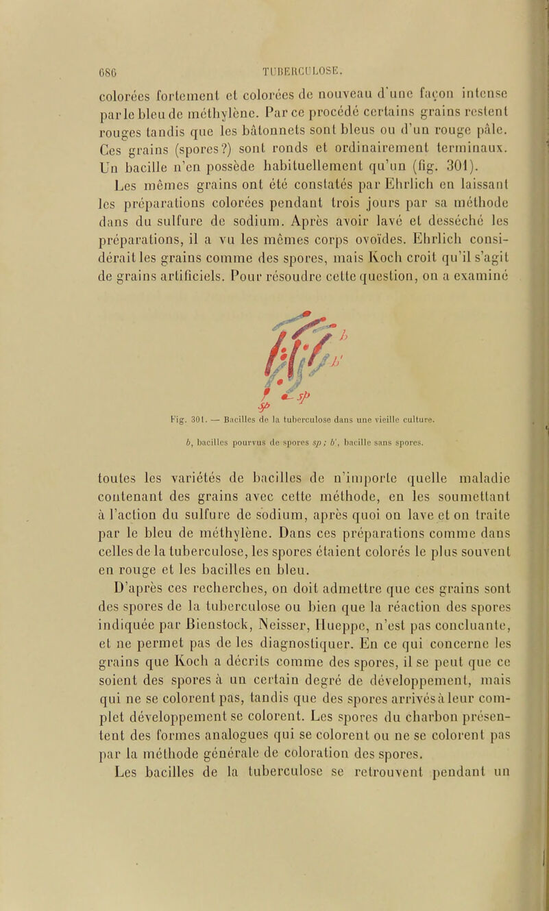 colorées forlomenl et colorées de nouveau d'une façon intense parle bleu de méthylène. Parce procédé certains grains restent rouges tandis que les bâtonnets sont bleus ou d'un rouge pâle. Ces grains (spores?) sont ronds et ordinairement terminaux. Un bacille n'en possède habituellement qu'un (fig. 301). Les mêmes grains ont été constatés par Ehrlich en laissant les préparations colorées pendant trois jours par sa méthode dans du sulfure de sodium. Après avoir lavé et desséché les préparations, il a vu les mêmes corps ovoïdes. Ehrlich consi- dérait les grains comme des spores, mais Koch croit qu'il s'agit de grains artificiels. Pour résoudre cette question, on a examiné l' ig. 301. — Bacilles de la tuberculose dans une vieille culture. b, bacilles pourvus de spores .<!/) ; b', bacille sans spores. toutes les variétés de bacilles de n'importe quelle maladie contenant des grains avec cette méthode, en les soumettant à l'action du sulfure de sodium, après quoi on lave et on traite par le bleu de méthylène. Dans ces préparations comme dans celles de la tuberculose, les spores étaient colorés le plus souvent en rouge et les bacilles en bleu. D'après ces recherches, on doit admettre que ces grains sont des spores de la tuberculose ou bien que la réaction des spores indiquée par Bienstock, Neisser, Hueppe, n'est pas concluante, et ne permet pas de les diagnostiquer. En ce qui concerne les grains que Koch a décrits comme des spores, il se peut que ce soient des spores à un certain degré de développement, mais qui ne se colorent pas, tandis que des spores arrivés à leur com- plet développement se colorent. Les spores du charbon présen- tent des formes analogues qui se colorent ou ne se colorent pas par la méthode générale de coloration des spores. Les bacilles de la tuberculose se retrouvent pendant un