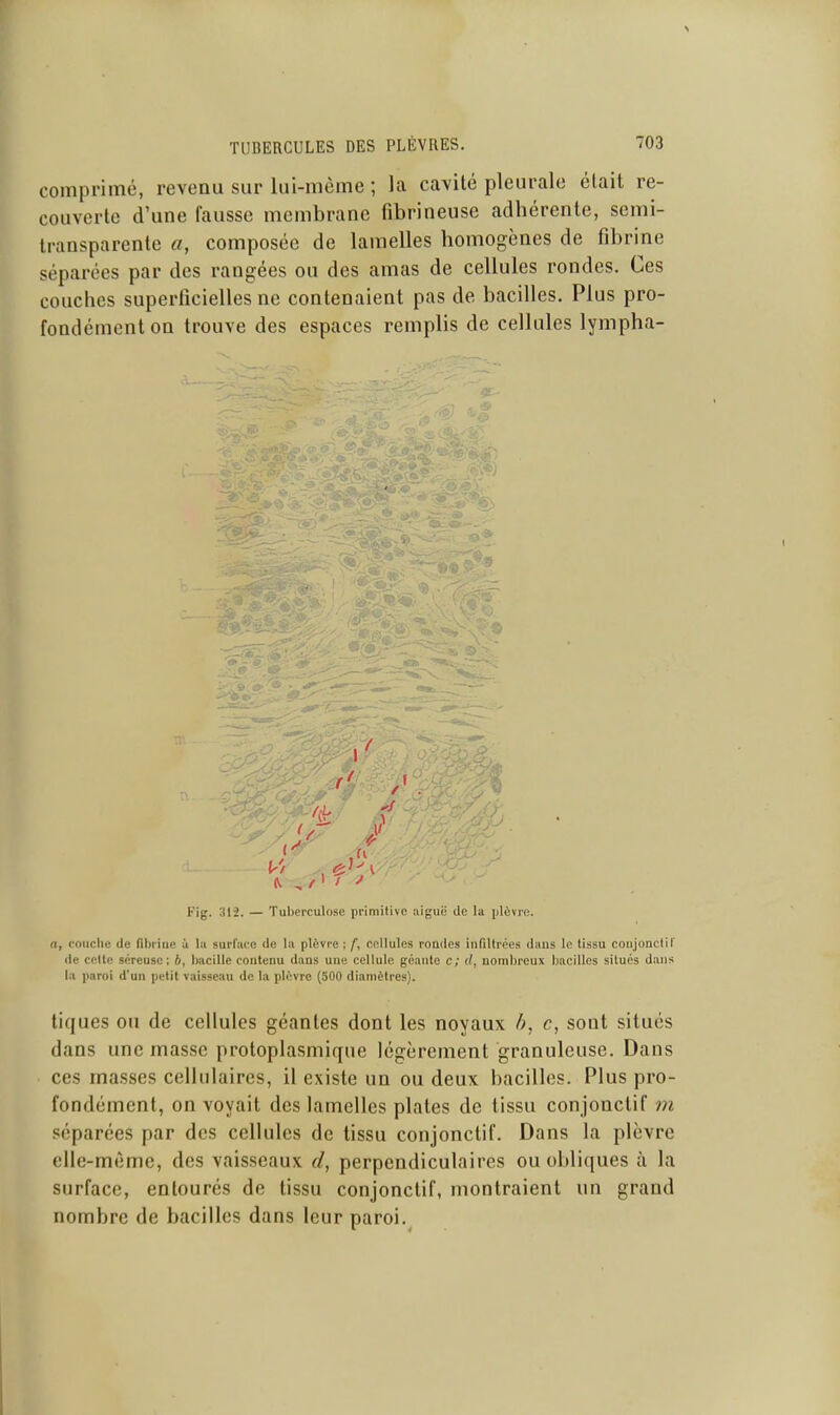 comprimé, revenu sur lui-même ; la cavité pleurale était re- couverte d'une fausse membrane fibrineuse adhérente, semi- transparente a, composée de lamelles homogènes de fibrine séparées par des rangées ou des amas de cellules rondes. Ces couches superficielles ne contenaient pas de bacilles. Plus pro- fondément on trouve des espaces remplis de cellules lympha- •5 1^ Kig. 312. — Tuberculose primitive !iigiië do l<i plèvre. a, couche de fibrine à lu surface de bi plèvre ; f, cellules roades infiltrées dans lo tissu conjonclil' de celle séreuse; b, bacille contenu dans une cellule géante c; d, nombreux bacilles situés dans 1.1 paroi d'un petit vaisseau de la plèvre (500 diamètres). tiques ou de cellules géantes dont les noyaux h, c, sont situés dans une masse protoplasmique légèrement granuleuse. Dans ces masses cellulaires, il existe un ou deux bacilles. Plus pro- fondément, on voyait des lamelles plates de tissu conjonctif m séparées par des cellules de tissu conjonctif. Dans la plèvre elle-même, des vaisseaux d, perpendiculaires ou obliques à la surface, entourés de tissu conjonctif, montraient un grand nombre de bacilles dans leur paroi.