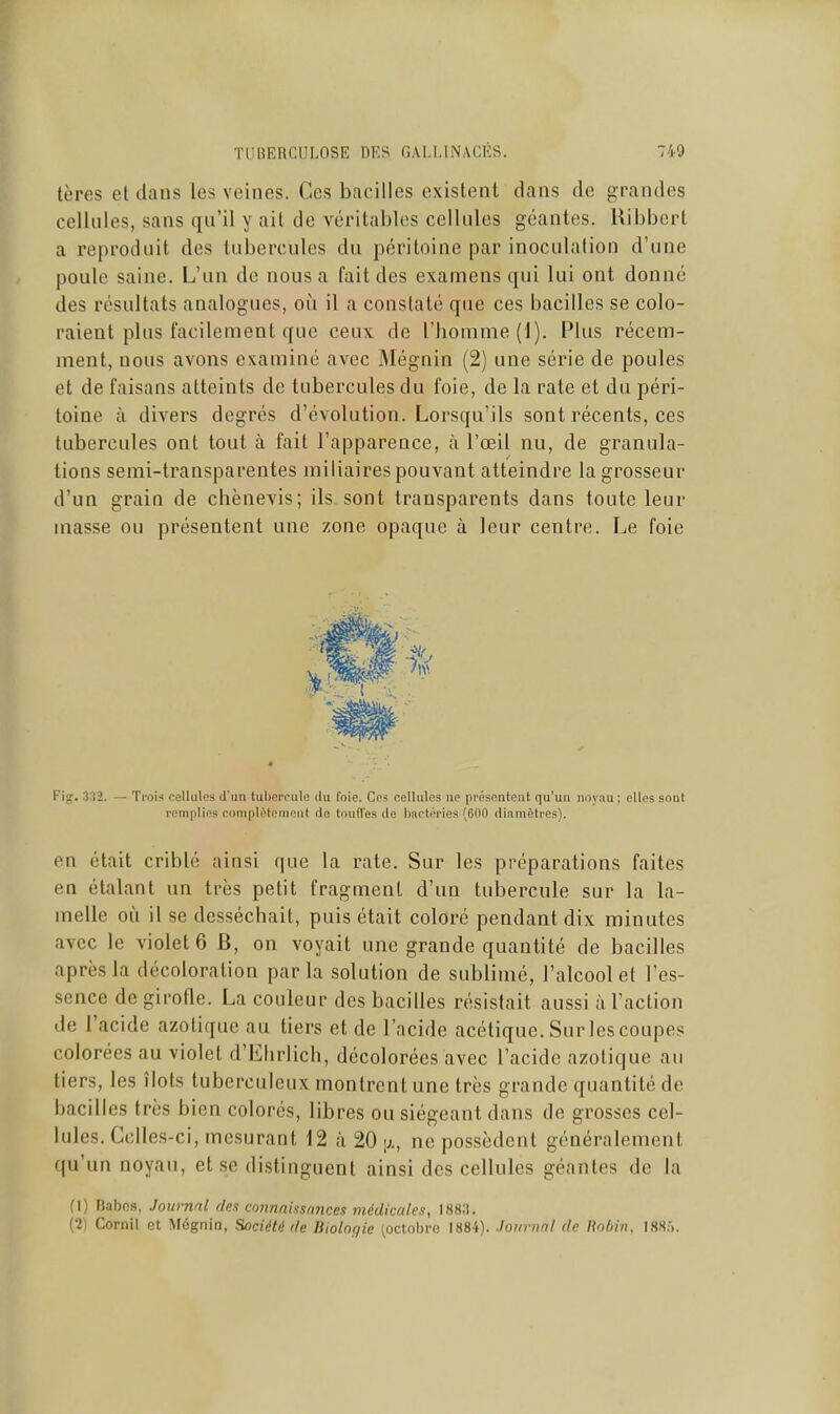 tères et dans les veines. Ces bacilles existent dans de grandes cellules, sans qu'il y ail de véritables cellules géantes. Ribbcrt a reproduit des tubercules du péritoine par inoculation d'une poule saine. L'un de nous a fait des examens qui lui ont donné des résultats analogues, oii il a constaté que ces bacilles se colo- raient plus facilement que ceux de l'homme (1). Plus récem- ment, nous avons examiné avec Mégnin (2) une série de poules et de faisans atteints de tubercules du foie, de la rate et du péri- toine à divers degrés d'évolution. Lorsqu'ils sont récents, ces tubercules ont tout à fait l'apparence, à l'œil nu, de granula- tions semi-transparentes miliaires pouvant atteindre la grosseur d'un grain de chènevis; ils sont transparents dans toute leur masse ou présentent une zone opaque à leur centre. Le foie Fig. 332. — Trois cellules d'un tubercule du foie. Ces cellules ne présentent qu'un noyau ; elles sont remplies complMoniniit de toufîes de Iwotf'ries (600 diamètres). en était criblé ainsi que la rate. Sur les préparations faites en étalant un très petit fragment d'un tubercule sur la la- melle où il se desséchait, puis était coloré pendant dix minutes avec le violet 6 B, on voyait une grande quantité de bacilles après la décoloration parla solution de sublimé, l'alcool et l'es- sence de girofle. La couleur des bacilles résistait aussi à l'action de l'acide azotique au tiers et de l'acide acétique. Sur les coupes colorées au violet d'Elirlich, décolorées avec l'acide azotique au tiers, les îlots tuberculeux montrent une très grande quantité de bacilles très bien colorés, libres ou siégeant dans de grosses cel- lules. Celles-ci, mesurant 12 à 20 [;,, ne possèdent généralement qu'un noyau, et se distinguent ainsi des cellules géantes de la (1) Babos, Journal (ks connaissances médkalea, 188:!. (2) Cornil et Mégnin, Société de Biolngie (octobre 1884). Journal de Hoùin. 188...