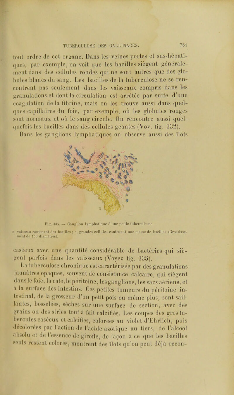 lotit ordrft de cet organe. Dans les \cines portes et sus-liépati- ([m>s, par exemple, on voit que les bacilles siègent générale- nientdans des cellules rondes qui ne sont autres que des glo- bules blancs du sang. Les bacilles de la tuberculose ne se ren- contrent pas seulement dans les vaisseaux compris dans les granulations et dont la circulation est arrêtée par suite d'une coagulation de la fibrine, mais on les trouve aussi dans quel- ques capillaires du foie, par exemple, où les globules rouges sont normaux et où le sang circule. On rencontre aussi quel- (luefois les bacilles dans des cellules géantes (Voy. fig. 332). Dans les ganglions lympbatiques on observe aussi des îlots s Fig. 333. — Gîinglion lymphatique d'une poule tuberculeuse. II. vaisseau contenant des bacilles; e, gv.indes cellules contenant une masse de bacilles (Gfossisse- mi iit de 130 diamètres). casécux avec une quantité considérable de bactéries qui siè- gent parfois dans les vaisseaux (Voyez fig. 335). La tuberculose chronique est caractérisée par des granulations jaunâtres opaques, souvent de consistance calcaire, qui siègent dans lo foie, la rate, le péritoine, les ganglions, les sacs aériens, et à la surlace des intestins. Ces petites tumeurs du péritoine in- testinal, de la grosseur d'un petit pois ou même plus, sont sail- lantes, bosselées, sèches sur une surface de section, avec des grains ou des stries tout à fait calcifiés. Les coupes des gros tu- bercules caséeux et calcifiés, colorées au violet d'iïhrlich, puis décolorées par l'action de l'acide azotique au tiers, de l'alcool absolu et de Fe.ssence de girofie, de façon à ce ([ue les bacilles seuls restent colorés, montrent des îlots qu'on peut déjà recon-