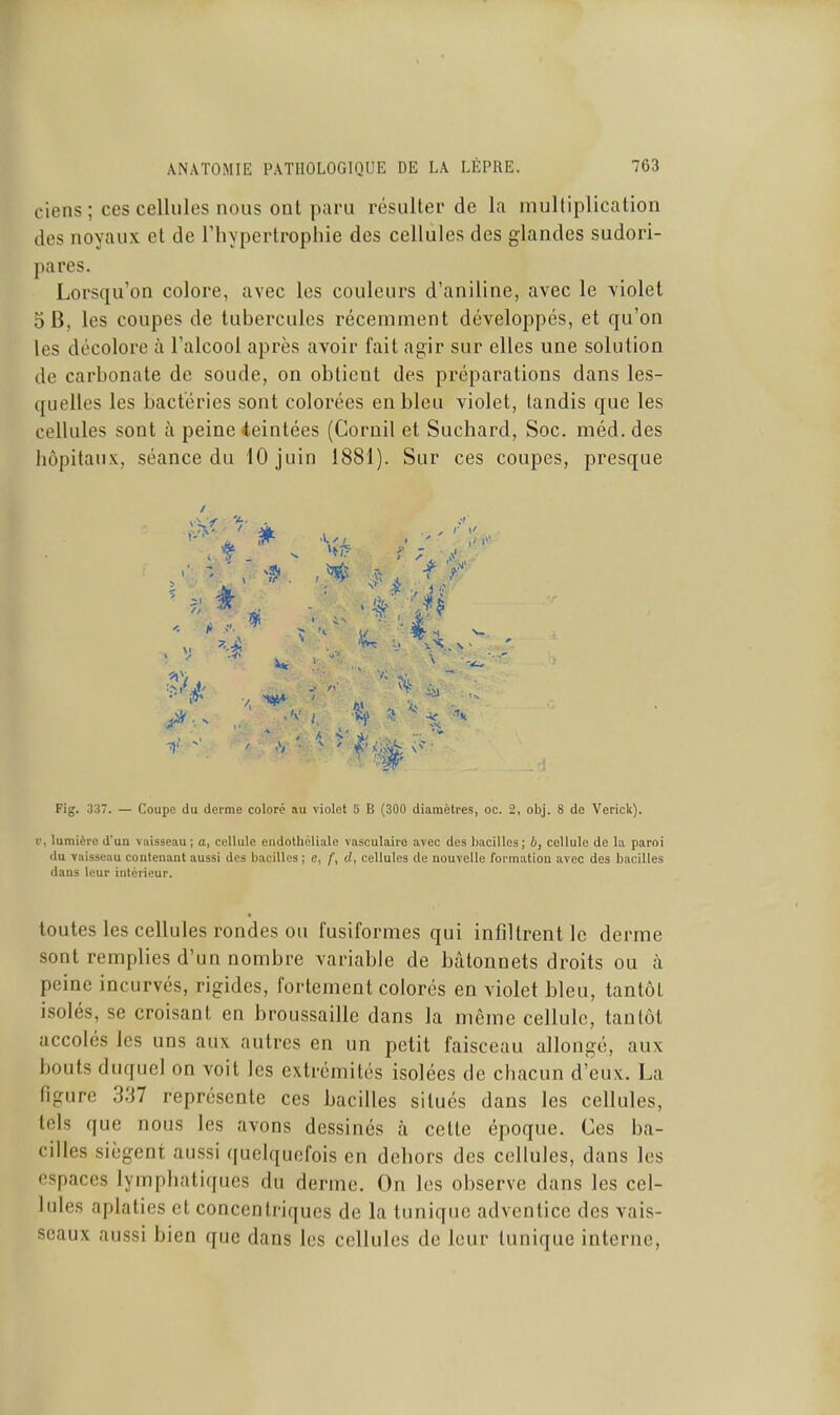 ciens ; ces cellules nous ont paru résulter de la multiplication des noyaux et de riiypertrophie des cellules des glandes sudori- pares. Lorsqu'on colore, avec les couleurs d'aniline, avec le violet 5 B, les coupes de tubercules récemment développes, et qu'on les décolore à l'alcool après avoir fait agir sur elles une solution de carbonate de soude, on obtient des préparations dans les- quelles les bactéries sont colorées en bleu violet, tandis que les cellules sont à peine teintées (Goruil et Suchard, Soc. méd. des hôpitaux, séance du 10 juin 1881). Sur ces coupes, presque / Fig. 337. — Coupe du derme coloré au violet 5 B (300 diamètres, oc. 2, obj. 8 de Verick). i), lumière d'un vaisseau; a, cellule eiidotliéliale vasculairo avec des bacilles; b, cellule de la paroi du vaisseau contenant aussi des bacilles ; e, f, d, cellules de nouvelle formation avec des bacilles dans leur intérieur. toutes les cellules rondes ou fusiformes qui infiltrent le derme sont remplies d'un nombre variable de bâtonnets droits ou à peine incurvés, rigides, fortement colorés en violet bleu, tantôt isolés, se croisant en broussaille dans la même cellule, tantôt accolés les uns aux autres en un petit faisceau allongé, aux bouts duquel on voit les extrémités isolées de chacun d'eux. La figure 3H1 représente ces bacilles situés dans les cellules, tels que nous les avons dessinés à cette époque. Ces ba- cilles siègent aussi quelquefois en dehors des cellules, dans les espaces lymphatiques du derme. On les observe dans les cel- lules aplaties et concentriques de la tunique adventice des vais- seaux aussi bien que dans les cellules de leur tunique interne,