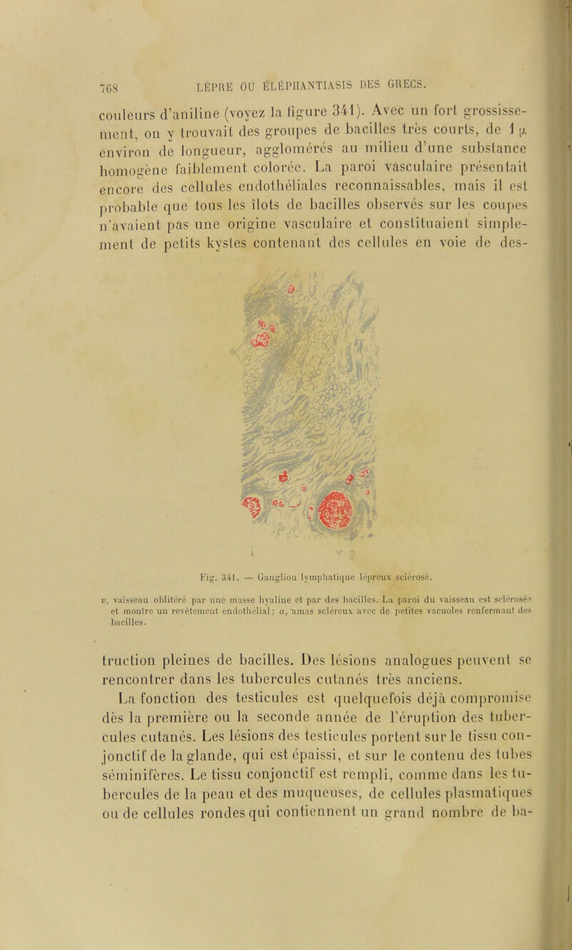 couleurs d'aniline (voyez la figure 341). Avec un fort grossisse- ment, on y trouvait des groupes de bacilles très courts, de i [j. environ de longueur, agglomérés au milieu d'une substance homogène faiblement colorée. La paroi vasculaire présentait encore des cellules endothéliales reconnaissables, mais il est probable que tous les îlots de bacilles observés sur les coupes n'avaient pas une origine vasculaire et constituaient simple- ment de petits kystes contenant des cellules en voie de des- Fig. 3il. — Ganglion lymphatique lépreux sclérosé. i), vaisseau oUitéré par une masse hyaline et par des bacilles. La paroi du vaisseau est sclérosé!* et montre un revêtement endothélial ; a, 'amas sclércux avec de petites vacuoles renfernianl des bacilles. truction pleines de bacilles. Des lésions analogues peuvent se rencontrer dans les tubercules cutanés très anciens. La fonction des testicules est quelquefois déjà compromise dès la première ou la seconde année de l'éruption des tuber- cules cutanés. Les lésions des testicules portent sur le tissu con- jonctif de la glande, qui est épaissi, et sur le contenu des tubes séminifères. Le tissu conjonctif est rempli, comme dans les tu- bercules de la peau et des muqueuses, de cellules plasmatiques ou de cellules rondes qui contiennent un grand nombre de ba-