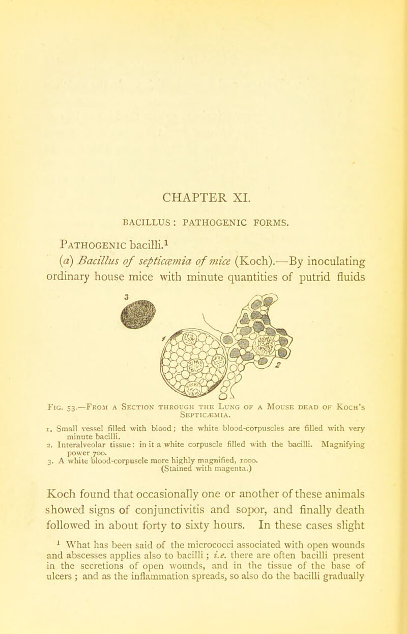 CHAPTER XL BACILLUS : PATHOGENIC FORMS. Pathogenic bacilli.1 (a) Bacillus of septicemia of mice (Koch).—By inoculating ordinary house mice with minute quantities of putrid fluids SePTIOEM 1. Small vessel filled with blood; the white blood-corpuscles are filled with very minute bacilli. 2. Interalveolar tissue: in it a white corpuscle rilled with the bacilli. Magnifying power 700. 3. A white blood-corpuscle more highly magnified, 1000, (Stained with magenta.) Koch found that occasionally one or another of these animals showed signs of conjunctivitis and sopor, and finally death followed in about forty to sixty hours. In these cases slight 1 What has been said of the micrococci associated with open wounds and abscesses applies also to bacilli; i.e. there are often bacilli present in the secretions of open wounds, and in the tissue of the base of ulcers ; and as the inflammation spreads, so also do the bacilli gradually