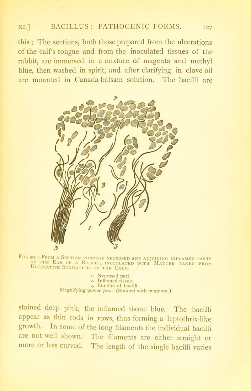 this : The sections, both those prepared from the ulcerations of the calf's tongue and from the inoculated tissues of the rabbit, are immersed in a mixture of magenta and methyl blue, then washed in spirit, and after clarifying in clove-oil are mounted in Canada-balsam solution. The bacilli are Fig. 59—From a Section through necrosed and adjoining inflamed parts of the Ear of a Raiiiut, inoculated with Matter taken from Ulcerative Stomatitis of the Calf. 1. Necrosed part. 2. Inflamed tissue. 3. Bundles of bacilli. Magnifying power 700. (Stained with magenta.) stained deep pink, the inflamed tissue blue. The bacilli appear as thin rods in rows, thus forming a leptothrix-like growth. In some of the long filaments the individual bacilli are not well shown. The filaments are either straight or more or less curved. The length of the single bacilli varies