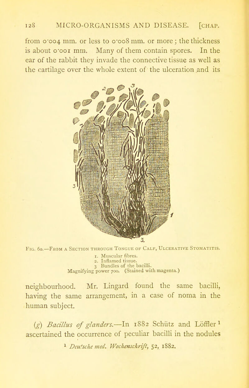 from o'oo4 mm. or less to o-oo8 mm. or more ; the thickness is about o'ooi mm. Many of them contain spores. In the ear of the rabbit they invade the connective tissue as well as the cartilage over the whole extent of the ulceration and its Fig. 60.—From a Section through Tongue of Calf, Ulcerative Stomatitis. 1. Muscular fibres. 2. Inflamed tissue. 3 Bundles of the bacilli. Magnifying power 700. (Stained with magenta.) neighbourhood. Mr. Lingard found the same bacilli, having the same arrangement, in a case of noma in the human subject. (g) Bacillus of glanders.—In 1882 Schiitz and Loftier 1 ascertained the occurrence of peculiar bacilli in the nodules 1 Deutsche med. Wochaischrift, 52, 1882.