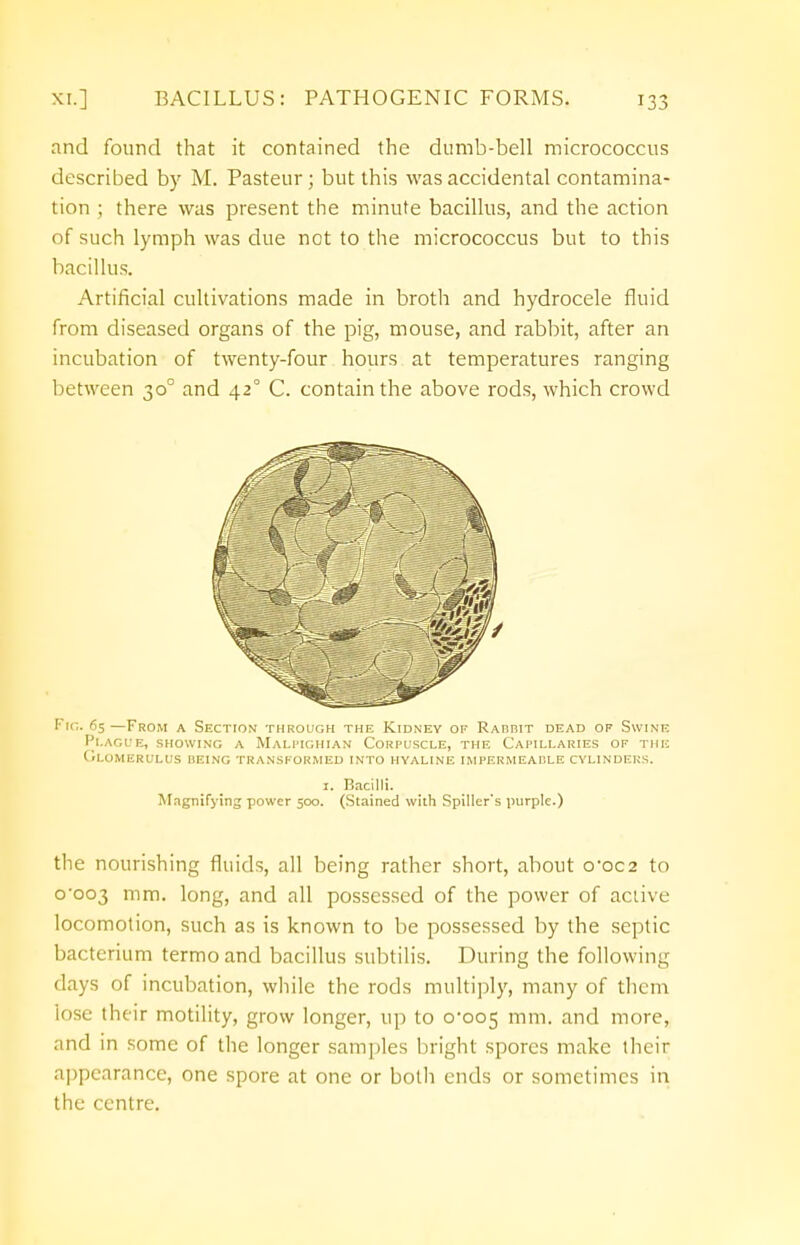 and found that it contained the dumb-bell micrococcus described by M. Pasteur; but this was accidental contamina- tion ; there was present the minute bacillus, and the action of such lymph was due not to the micrococcus but to this bacillus. Artificial cultivations made in broth and hydrocele fluid from diseased organs of the pig, mouse, and rabbit, after an incubation of twenty-four hours at temperatures ranging between 300 and 420 C. contain the above rods, which crowd Fig. 65 —From a Section through the Kidney of Rabbit dead of Swine Plague, showing a Malpighian Corpuscle, the Capillaries of the (Glomerulus being transformed into hyaline impermeable cylinders. the nourishing fluids, all being rather short, about 0-002 to o-oo3 mm. long, and all possessed of the power of active locomotion, such as is known to be possessed by the septic bacterium termo and bacillus subtilis. During the following days of incubation, while the rods multiply, many of them lose their motility, grow longer, up to 0-005 mm- ar>d more, and in some of the longer samples bright spores make their appearance, one spore at one or both ends or sometimes in the centre. 1. Bacilli. Magnifying power 500. (Stained with Spiller's purple.)