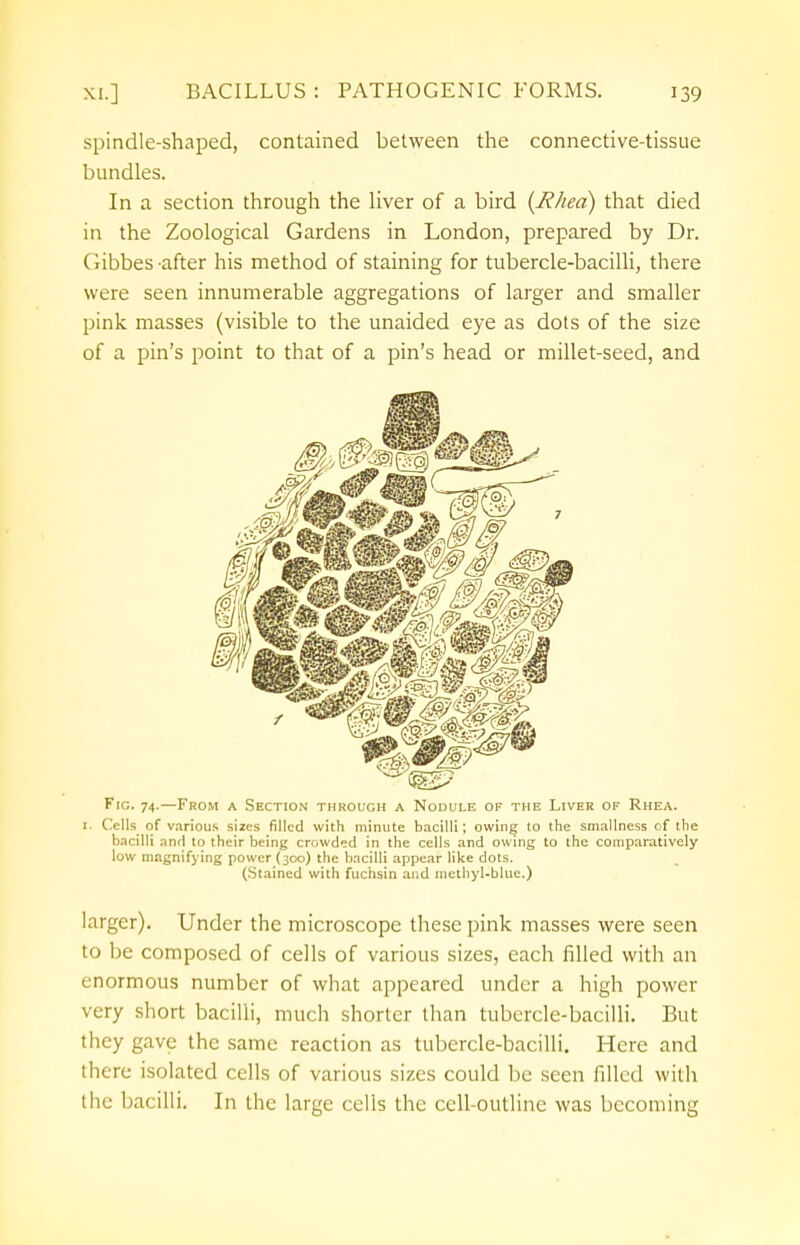 spindle-shaped, contained between the connective-tissue bundles. In a section through the liver of a bird {Rhea) that died in the Zoological Gardens in London, prepared by Dr. Gibbes -after his method of staining for tubercle-bacilli, there were seen innumerable aggregations of larger and smaller pink masses (visible to the unaided eye as dots of the size of a pin's point to that of a pin's head or millet-seed, and Fig. 74.—From a Section through a Nodule of the Liver of Rhea. 1. Cells of various sizes filled with minute bacilli; owing lo the smallness of the bacilli anri to their being crowded in the cells and owing to the comparatively low magnifying power (300) the bacilli appear like dots. (Stained with fuchsin and methyl-blue.) larger). Under the microscope these pink masses were seen to be composed of cells of various sizes, each filled with an mormons number of what appeared under a high power very short bacilli, much shorter than tubercle-bacilli. But they gave the same reaction as tubercle-bacilli. Here and there isolated cells of various sizes could be seen filled with the bacilli. In the large cells the cell-outline was becoming