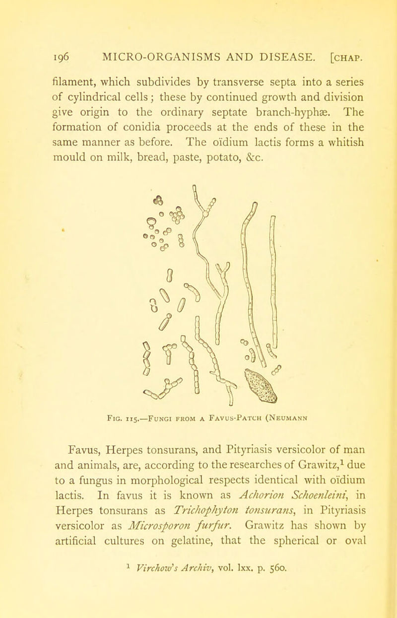 filament, which subdivides by transverse septa into a series of cylindrical cells; these by continued growth and division give origin to the ordinary septate branch-hyphae. The formation of conidia proceeds at the ends of these in the same manner as before. The oi'dium lactis forms a whitish mould on milk, bread, paste, potato, &c. Fig. 115.—Fungi from a Favus-Patch (Neumann Favus, Herpes tonsurans, and Pityriasis versicolor of man and animals, are, according to the researches of Grawitz,1 due to a fungus in morphological respects identical with o'idium lactis. In favus it is known as Achorion Schoenleinii, in Herpes tonsurans as Trichophyton tonsurans, in Pityriasis versicolor as Microsporon furfur. Grawitz has shown by artificial cultures on gelatine, that the spherical or oval