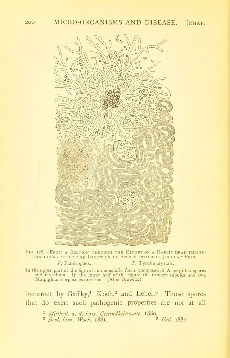 Fig. 118.—From a Section through the Kidney of a Rabbit dead thirty- six HOURS AFTER THE INJECTION OF SPORES INTO THE JUGULAR VEIN. F. Fat droplets. T. Tyrosin crystals. In the upper part of the figure is a metastatic focus composed of Aspergillus spores and mycelium. In the lower half of the figure the urinary tubules and two Malpighian corpuscles are seen. (After Grawitz.) incorrect by Gaffky,1 Koch,2 and Leber.3 Those spores that do exert such pathogenic properties are not at all 1 MittheU. a. d. kais. Gesundheitsamte, 1880. 8 Bcrl. klin. Woch. 1881. 3 Ibid. 1S82.