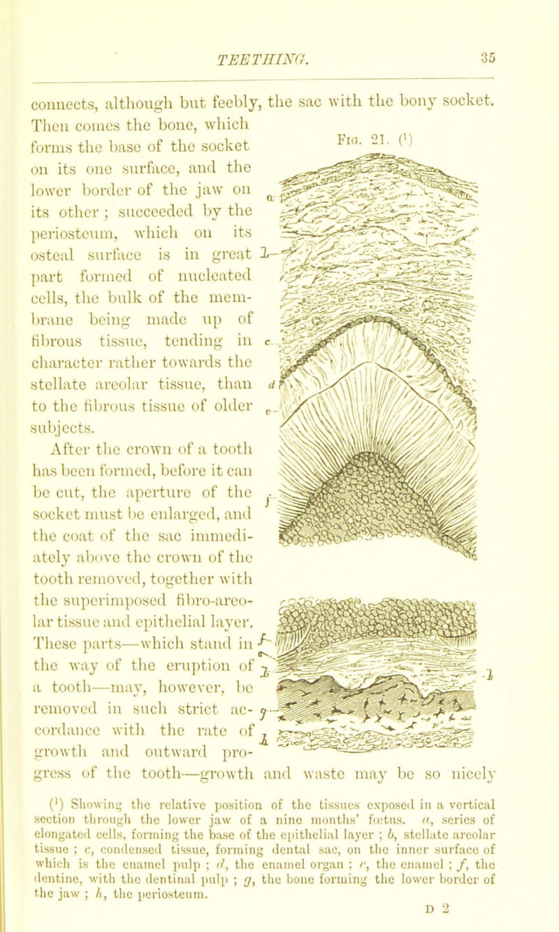 connects, altliough but feebly, the sac with the bony socket. Then comes the bone, which forms the base of the socket on its one surface, and the lower border of the jaw on its other ; succeeded by tlie periostcmn, wliich on its ^ ^ osteal surface is in great 'i--'^^:'/^^-;^^^-^ part formed of nucleated cells, the bulk of the mem- brane being made up of fibrous tissue, tending in character rather towards the stellate areolar tissue, than to the fibrous tissue of older subjects. After the crown of a tooth has been formed, before it can be cut, the aperture of the socket must be enlarged, and the coat of the sac inmicdi- ately above the crown of tlie tooth removed, together with the superimposed fibro-areo- lar tissue and epithelial layer. Tiiese parts—which stand in ^ the way of the eniptiou of j  a tooth—may, however, be removed in such strict ac- y- cordauce with the rate of growth and outward pro- gress of the tooth—growth and waste ma}' be so nicely (') Sliowin;; the relative position of the tissues exposed in a vertical section ttirongh the lower jaw of a nine months' f(otus. a, scries of elongateil cells, forming the base of the epitiielial layer ; b, stellate areolar tissue ; c, conilonseil tissue, forming dental sac, on the inner surface of which is the enamel pulp ; the enamel organ : i\ the enamel ; /, the dentine, with the dentinal puli) ; <j, the hone forming the lower border of the jaw ; h, the periosteum. D 2