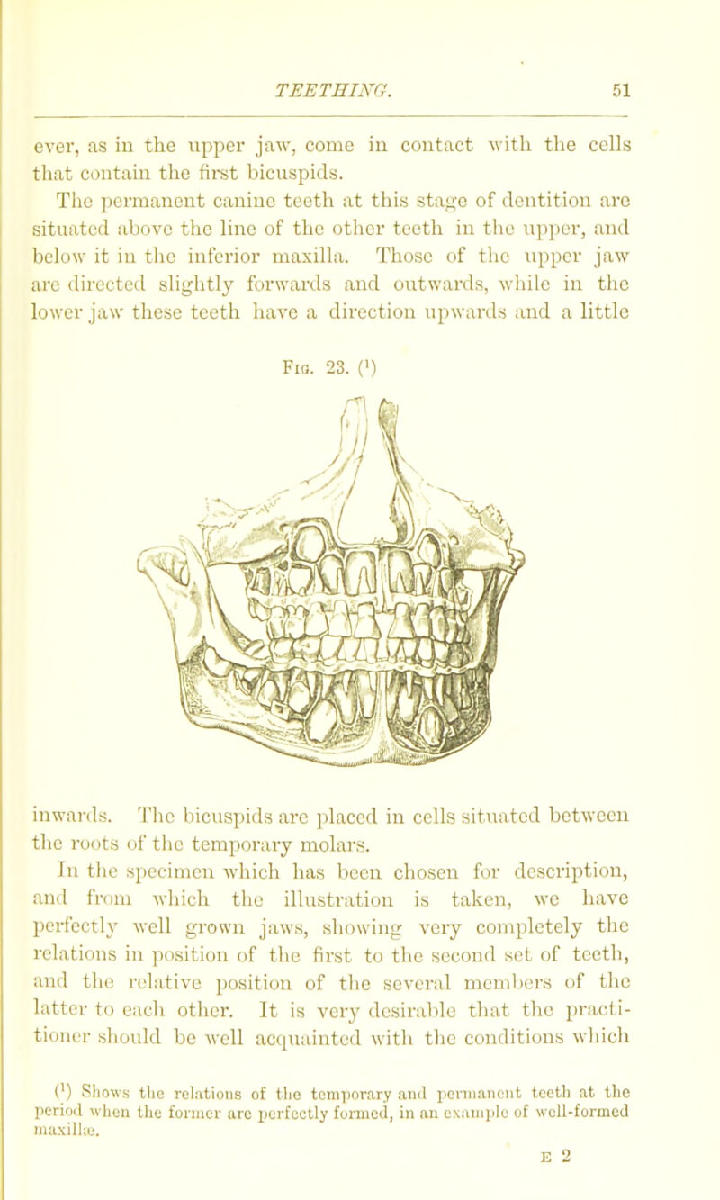 ever, as in the upper jaw, come in contact with the cells that contain the first bicuspids. The permanent canine teeth at this stage of dentition are situated above the line of the other teeth in tlie upper, and below it in the inferior maxilla. Those of the upper jaw arc directed slightly forwards and outwards, while in the lower jaw these teeth liavc a direction u])ward.s and a little Fio. 23. (') inwards. The bicuspids arc jilaccd in cells situated between tlie roots of tlie temporary molai's. In the specimen which has been chosen for description, and from wliich the illustration is taken, we have perfectly well grown jaws, showing very completely the relations in position of the first to the second set of teeth, and the relative position of the several members of tlie latter to each other. It is very dcsiral)le that the practi- tioner should be well accpiaintcd witli tlic conditions which (') SIiow.s the relations of the temporary and pcrniancnt teeth at the period when the former are perfectly formed, in an example of well-formed muxilhu. E 2