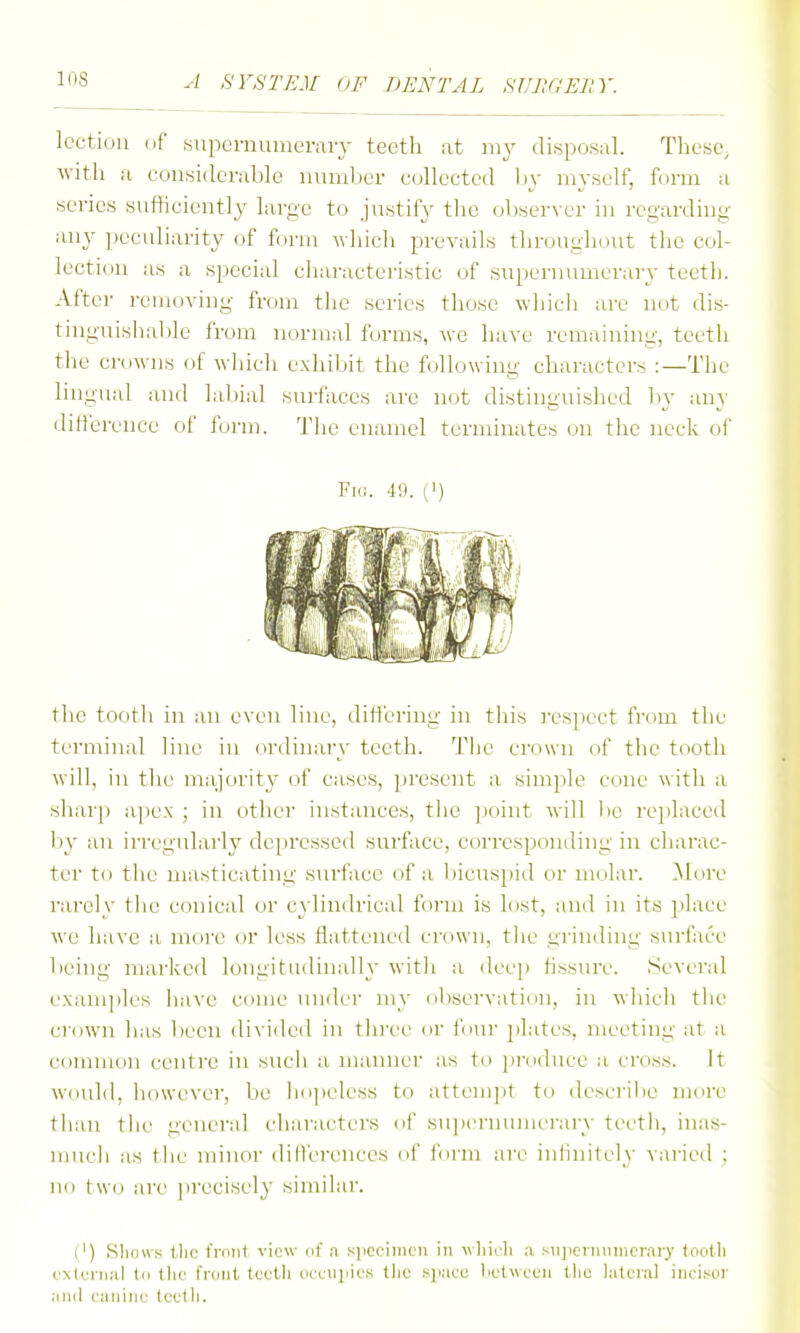 lection (if isupei-munerary teeth at mj' disposal. These^ with a considerable nundjcr collected b\- myself, form a series sufficiently large to justify the observer in regarding any peculiarity of form which prevails throughout the col- lection as a special cliaracteristic of supernumerary teeth. After removing from the scries those which are not dis- tinguishable from normal forms, we have remaining, teeth tlie croo ns of wliich exhibit the following characters :—The lingual and labial surfaces arc not distinguished by any difference of f(irm. Tiie enamel terminates on the neck oi' Fid. 49. (1) the tooth in an even line, differing in this respect from the terminal line in ordinary teeth. The crown of the tooth will, in the majority of cases, present a simple cone with a sharp apex ; in other instances, tiie ])oint will be replaced by an irregularly depressed surface, corresponding in charac- ter to the masticating surface of a l)icuspid or molar, ^b.ire rarely the conical or cylindrical form is lost, ;uid in its place we have a more or less flattened crciwn, the grinding surface l>cing marke<l longitudinally with a deej) hssure. Several exam])les have come under my observation, in which the crown has been di\'i(led in three (ir four plates, meeting at a common centre in sucli a manner as to iiroduce a cross. It woidd, however, be h(i])ek'ss to attempt to desci'ibe more than the general charactci's (if su]iernumerarv teeth, inas- mueli as tiie minor dilVerences (if fbrm are inhnilcly varied ; no two are precisely similar. (') SlioH'f; the fniiit view nf a s]icciiiien in wliii-li a s>i])cinMiiicrary tootli I'xlcnial 1(1 tlic rrmil tc'clli ii(_'(.uiiics the spact; lit'tweeii llio lateral iiici.vor ;iiul canine tedli.