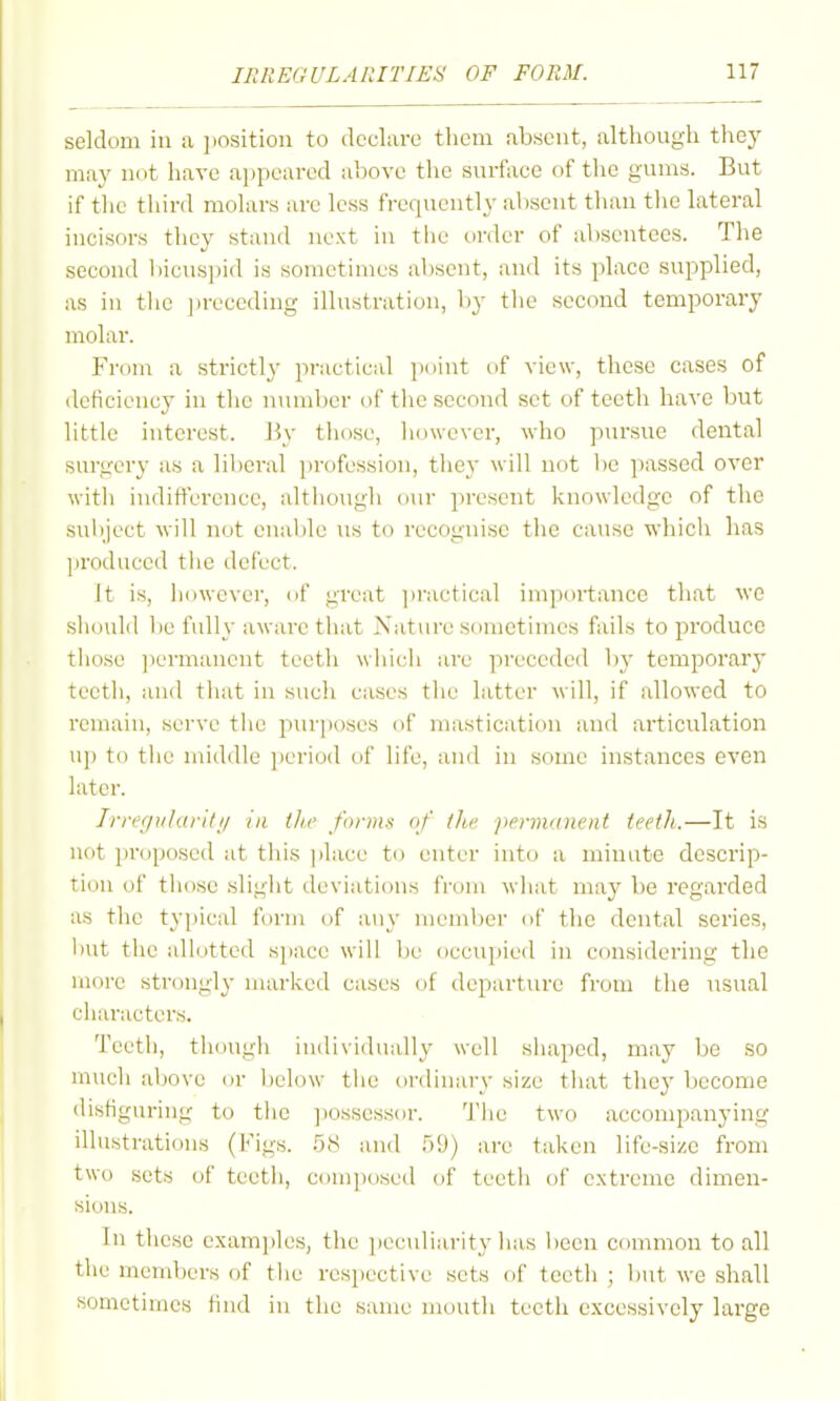 seldom in a jiosition to declare them absent, although they may not have appeared above the surface of tlie gums. But if the third molars are less frequently absent than the lateral incisors they stand next in tlie order of absentees. The second bicus])id is sometimes absent, and its place supplied, as in tlic ])receding illustration, by the second temporary molar. From a strictly practical point of view, these cases of deficiency in the number of the second set of teeth have but little interest. J\v those, however, who pursue dental surgery as a lilieral profession, they will not be ])asscd over with indifterence, although our present knowledge of the suhject will not enal)le us to recognise the cause which has ]iroduced tlie defect. It is, however, of great ])ractical importance that wo sh(nild l)e fully aware that A'ature scuuetimes fails to produce tliose ])ermancnt teeth which are preceded by temporary teeth, and that in such cases the latter will, if allowed to remain, serve t!ie pur|)oses of mastication and articulation u]) to tlie middle jteriod of life, and in some instances even later. Jm'cpilavliii ill t/ir fi»-)iix of (Iw jiennanent teeth.—It is not proposed at this place to enter into a minute descrip- tion of tiiose sliglit deviations from what may be regarded as the ty]iieal form of any member of the dental series, liut the allotted s](ace will be occu])ied in considering the more strongl}- marked cases of departure from the usual cii;u'acters. Teetli, tiiough iiidividiiid!\- well shaped, may be so much above or below the ordinary size that they become disfiguring to the ])ossessor. Tlie two accompanying illustrations (Figs. 58 and 59) are taken life-size from two sets of teeth, composed of teeth of extreme dimeu- si(_)us. In these exam])les, the ])ecnliarity has been common to all the members of the resiiective sets of teeth ; but we shall sometimes find in the same mouth teeth excessively large