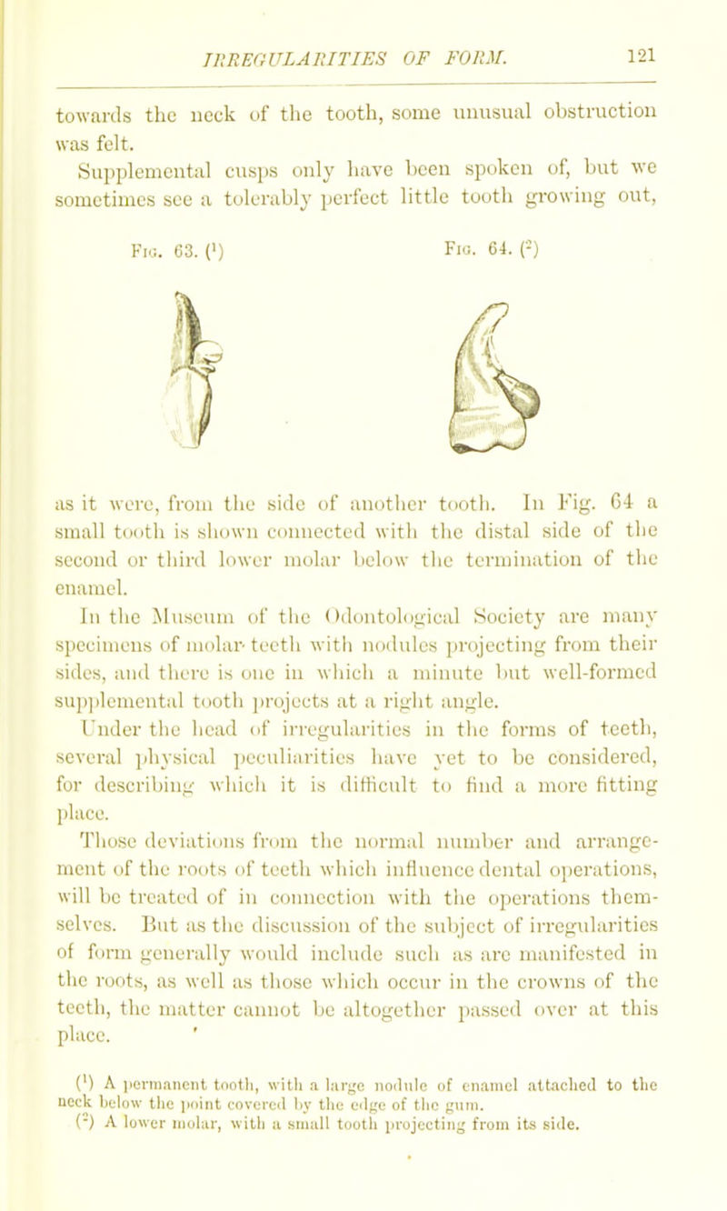 towards the neck of the tooth, some unusual obstruction was felt. Supplemental cusps only have been spoken of, but we sometimes see a tolerably perfect little tooth growing out, Fic. 63. (') Fio. 64. (-) as it were, from the side of another tooth. In Fig. 64 a small to(»th is shown connected witli tlie distal side of the second or third lower molar below tiic termination of the enamel. In the Museum of the Odoutological Society are many specimens of molar-teeth with nodules projecting from their sides, and there is one iu wiiich a minute but well-formed sup])lcmental tooth ])rojects at a riglit angle. I'nder the head of irregularities in the forms of teeth, several physical ])eculiai-ities have yet to be considered, for describing wliicli it is ditlicult to find a more fitting place. Tliosc deviations from the normal number and arrange- ment of tile roots of teeth wliicli inlluence dental operations, will be treated of in connection with tlie operations them- selves. But as the discussion of the subject of irregularities of form generally would include sucli as are manifested in the roots, as well as those which occm- iu the crowns of the teeth, the matter cannot be altogetlier passed over at this place. (') A permanent tnotli, with a larjje nodule of enamel attached to tlic neck below the point covered by the edge of the gum. {■) A lower niohir, with a small tooth projecting from its .side.