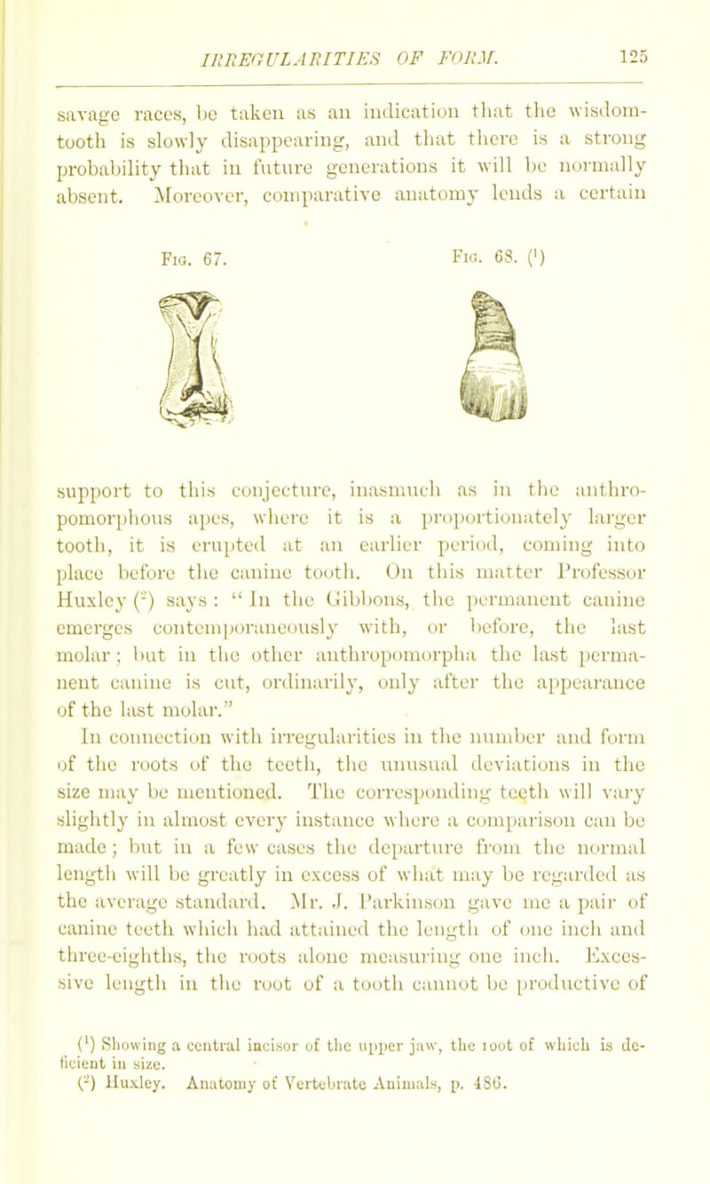 savage races, be taken as an indication tliat the wisdom- tooth is slowly disappearing, and that there is a strong probability that in future generations it will be normally absent. ^loreover, comparative anatomy lends a certain Fio. 67. Fir,. C8. (') support to this conjecture, inasmuch as in the anthro- pomorphous apes, where it is a i)roportionatcly larger tooth, it is erupted at an earlier period, coming into place before the canine tooth. On this matter Professor Huxley (-) says :  In the (Jibbons, the permanent canine emerges contemporaneously with, or Itefore, the last molar; but in the other anthropomorpha the last i)crma- nent canine is cut, ordinarily, only after the a[)pearance of the last molar. In connection with irregularities in the number and form of the roots of the teeth, the iinusvud deviations in tlic size may be mentioned. The corresponding teeth will vai-y slightly in almost every instance where a comparison can be made; b\it in a few cases the departure from the normal length will be greatly in excess of what may be regarded as the average standard. Mr. .1. I'arkinscju gave me a pair of canine teeth which had attained the length of one inch and three-eighths, the roots alone measuring one inch. Exces- sive length in the root of a tooth cannot be [)roductive of (') Sliowing a central incisor of the upper jaw, the loot of which is dc- ticieiit in size. (-) lIu.Yley. Anatomy of Vertebrate Animals, p. 480.