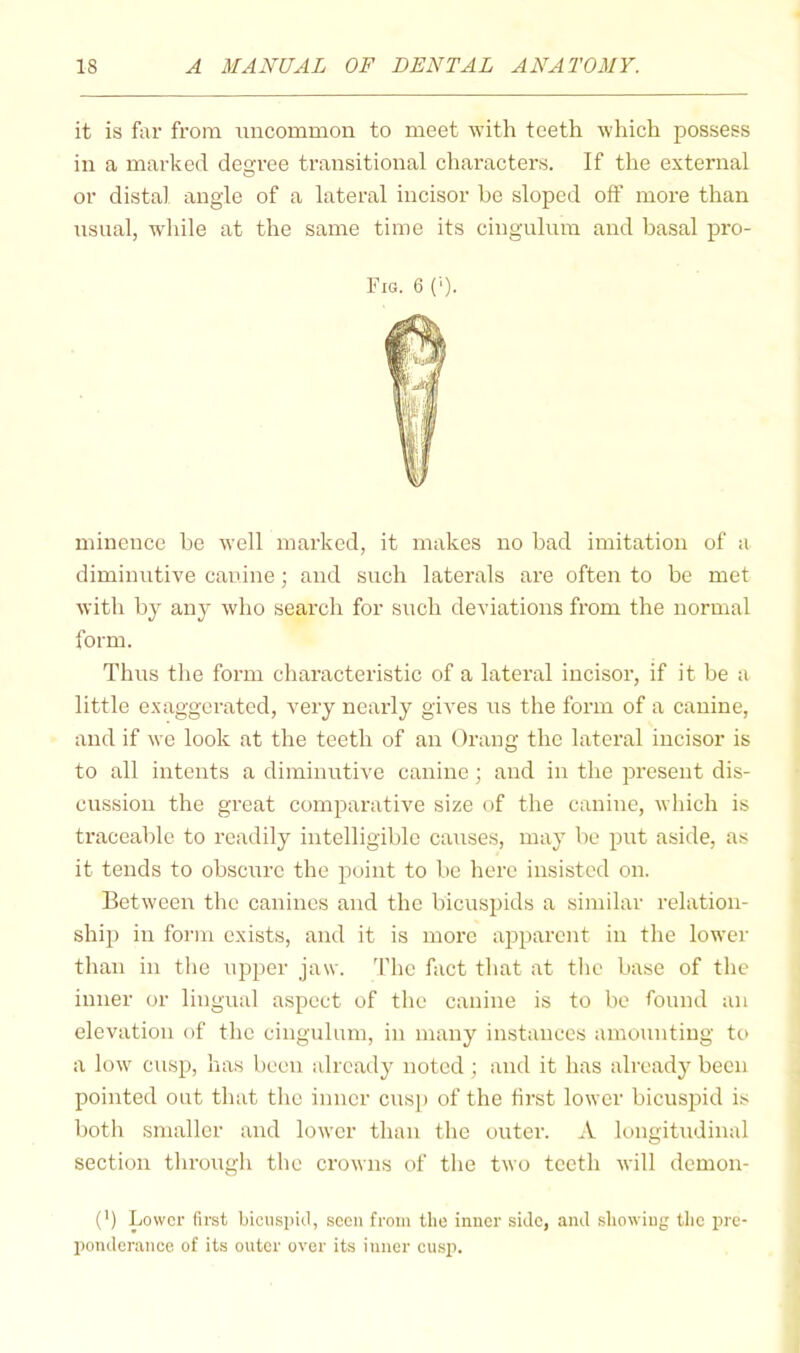 it is far from uncommon to meet with teeth which possess in a marked degree transitional characters. If the external or distal angle of a lateral incisor be sloped off more than usual, wlnle at the same time its cingulum and basal pro- Fig. 6 C‘). ininence be well marked, it makes no bad imitation of a diminutive canine; and such laterals are often to be met with by any who search for such deviations from the normal form. Thus the form characteristic of a lateral incisor, if it be a little exaggerated, very nearly gives us the form of a canine, and if we look at the teeth of an Orang the lateral incisor is to all intents a diminutive canine; and in the present dis- cussion the great comparative size of the canine, which is traceable to readily intelligible causes, may be put aside, as it tends to obscure the point to be here insisted on. Between the canines and the bicuspids a similar relation- ship in form exists, and it is more apparent in the lower than in the upper jaw. The fact that at the base of the inner or lingual aspect of the canine is to be found an elevation of the cingulum, in many instances amounting to a low cusp, has been already noted ; and it has already been pointed out that the inner cus[) of the first lower bicuspid is both smaller and lower than the outer. A longitudinal section through the crowns of the two teeth will demon- (') Lower first bicuspid, seen from the inner side, and showing the pre- ponderance of its outer over its inner cu.sp.