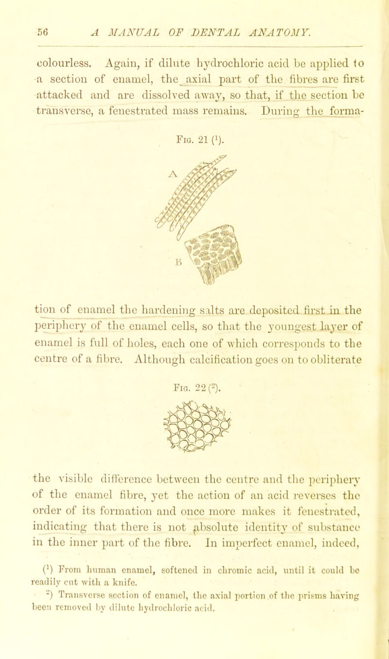 colourless. Again, if dilute hydrochloric acid be applied to a section of enamel, the^xial part of the fibres are first attacked and are dissolved away, so that, if the section ho transverse, a fenestrated mass remains. During the forma- Fig. 21 ('). tmn of enamel the hardening salts are deposited first in the periphery of the enamel cells, so that the 3’onngest laj'er of enamel is full of holes, each one of which corresponds to the centre of a fibre. Although calcification goes on to obliterate Fig. 22(=). the visible difi'erence between the centre and the periphery of the enamel fibre, yet the action of an acid reverses the order of its formation and once more makes it fenestrated, indicating that there is not p,bsolute identity of substance in the inner part of the fibre. In imperfect enamel, indeed, (') From luiman en.imel, softened in chromic acid, until it could he readily cut with a knife. ) Traii.svcr.se section of enamel, the axial iiortion of the prisms h.aviiig been removed hy dilute hydrochloric acid.