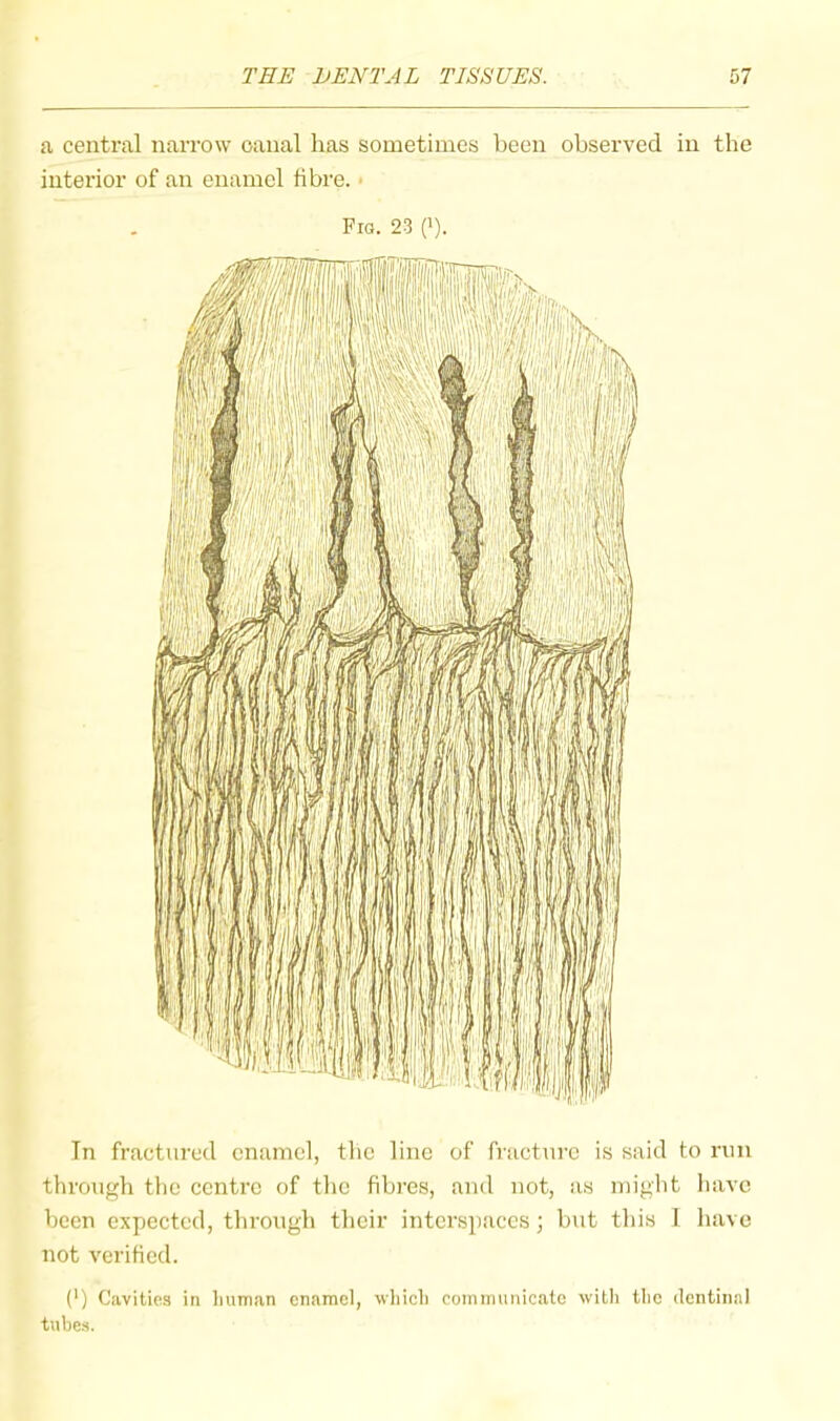 a centml narrow oanal has sometimes been observed in the interior of an enamel bbre. ■ Fig. 23 ('). Tn fractured enamel, the line of fracture is said to run tbrougb the centre of the fibres, and not, as might have been expected, tbrougb tbeir interspaces; but this I liave not verified. (') Cavities in liuman enamel, vvhicli commuiiicate willi tlie dentinal tube.s.