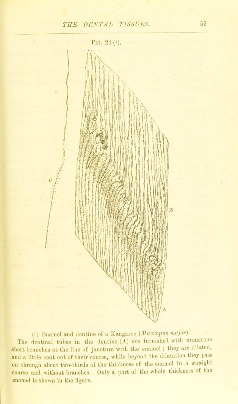 Fig. 24 ('). (') Enamel and dentine of a Kangaroo {Macropus major). The dentinal tubes in the dentine (A) are funiished with numerous short branches at the lino of juncture with the enamel; they are dilated, and a little bent out of their course, while beyond the dilatation they jjass on through about two-thirds of the thickness of the enamel in a straight course and without branches. Only a part of the whole thickness of the enamel is shown in the figure.