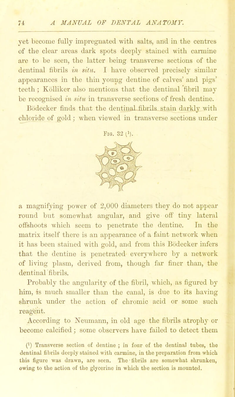 yet become fully impregnated with salts, and in the centres of the clear areas dark spots deeply stained with caiTuine are to be seen, the latter being transverse sections of the dentinal fibrils in situ. I have observed precisely similar appearances in the thin young dentine of calves’ and pigs’ teeth ; Kolliker also mentions that the dentinal fibril may be recognised in situ in transverse sections of fresh dentine. Bodecker finds that the dentinakfibrils stain darkly with chloride of gold; when viewed in ti-ansverse sections under Fia. 32 a magnifying power of 2,000 diameters they do not appear round but somewhat angular, and give off tiny lateral offshoots which seem to penetrate the dentine. In the matrix itself there is an appearance of a faint network when it has been stained with gold, and from this Bodecker infers that the dentine is penetrated everywhere by a network of living plasm, derived from, though far finer than, the dentinal fibrils. Probably the angularity of the fibril, which, as figured by him, is much smaller than the canal, is due to its having shrunk under the action of chromic acid or some sucli reagent. According to Neumann, in old age the fibrils atrophy or become calcified ; some observers have failed to detect them (’) Transverse section of dentine ; in four of the dentinal tubes, the dentinal fibrils deeply stained witli carmine, in the preparation from which this figure was drawn, are seen. The fibrils are somewhat shrunken, owing to the action of the glycerine in which the section is mounted.