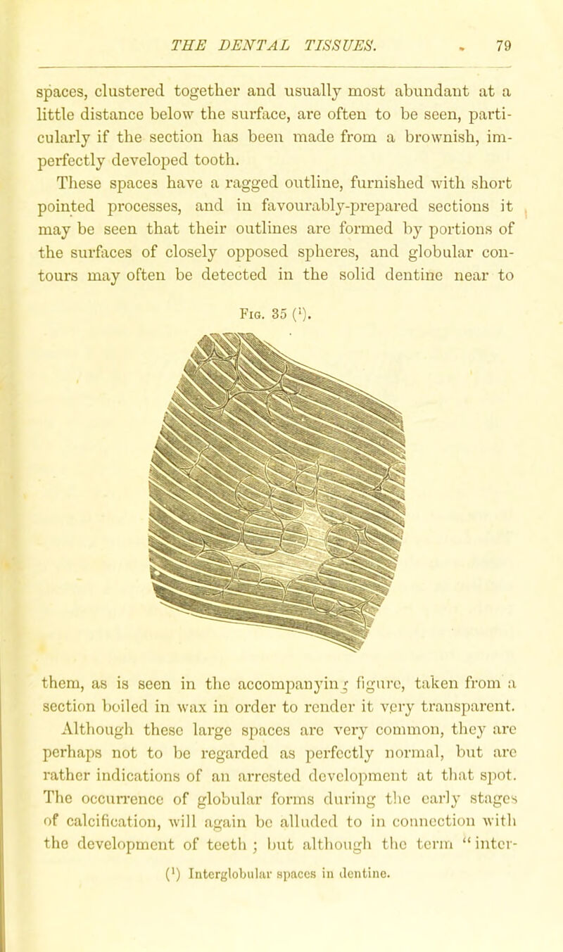 spaces, clustered together and usually most abundant at a little distance below the surface, are often to be seen, parti- cularly if the section has been made from a brownish, im- perfectly developed tooth. These spaces have a ragged outline, furnished with short pointed processes, and in favoimrbly-prepared sections it may be seen that their outlines are formed by portions of the surfaces of closely opposed spheres, and globular con- tours may often be detected in the solid dentine near to Fm. 35 (*). them, as is seen in the accompanying figure, taken from a section boiled in wax in order to render it vpry transparent. Although these large spaces arc very common, they arc perhaps not to be regarded as perfectly normal, but arc rather indications of an arrested development at tliat sjiot. The occuri’encc of globular forms during tlic early stages of calcification, will again be alluded to in connection with the development of teeth ; Init although the term “ intcr- (') Intcrglobular spaces in dentino.