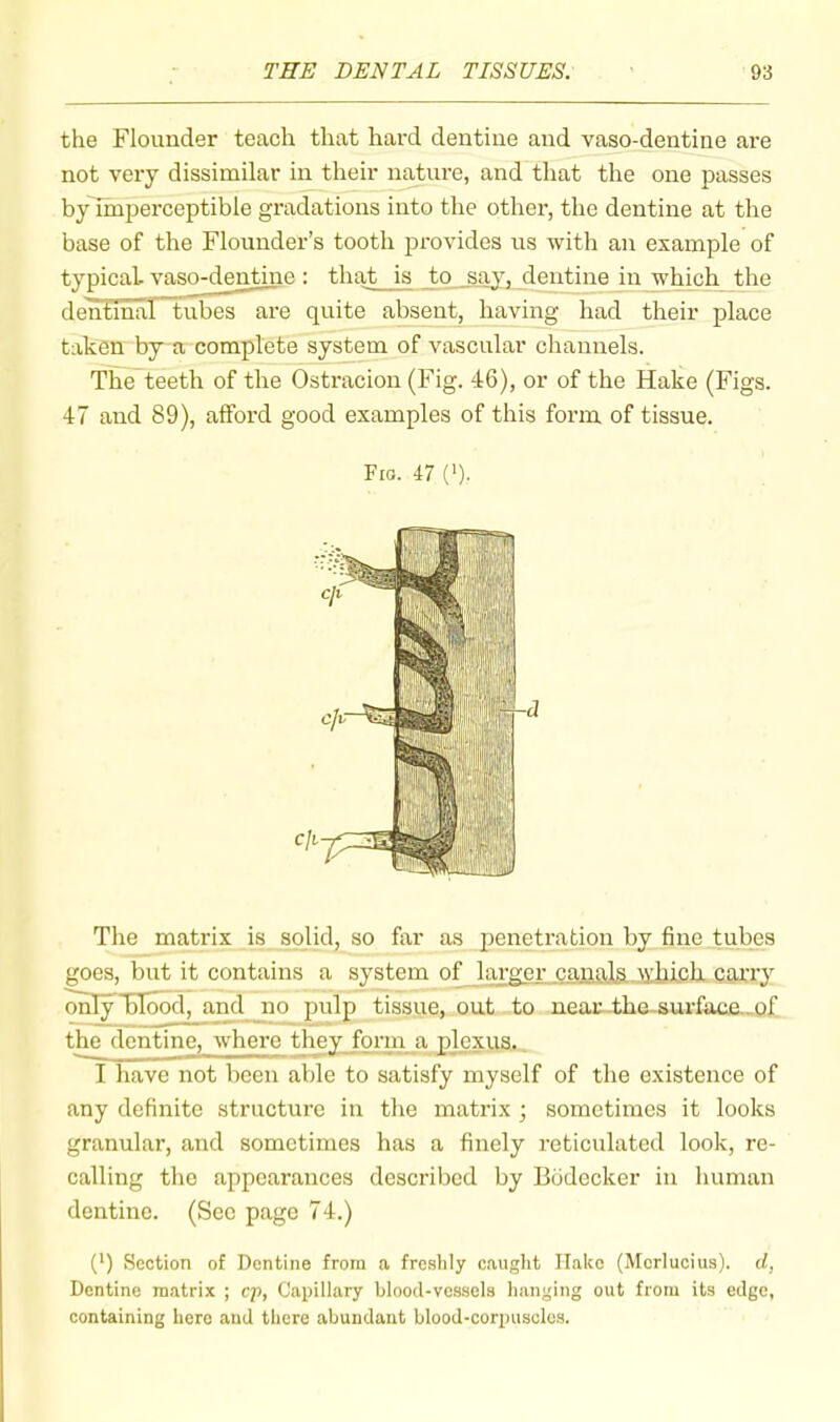 the Flounder teach that hard dentine and vaso-dentine are not very dissimilar in their nature, and that the one passes by imperceptible gradations into the other, the dentine at the base of the Flounder’s tooth provides us with an example of typical vaso-dentine: that is to say, dendne in which the deliEihar tubes”^e quite absent, having had their place taken by a complete system of vascular channels. The teeth of the Ostracion (Fig. 46), or of the Hake (Figs. 47 and 89), afford good examples of this form, of tissue. The matrix is solid, so far as penetration by fine tubes goes, but it contains a system of larger canala .mIjIcIx carry I have not been able to satisfy myself of the existence of any definite structure in the matrix ; sometimes it looks granular, and sometimes has a finely reticulated look, re- calling the appearances described by Budecker in human dentine. (Sec page 74.) (') Section of Dentine from a freshly caught Hake (Mcrlucius). d, Dentine matrix ; cp, Capillary blood-vessels hanging out from its edge, containing here and there abundant blood-corpuscles. Fra. 47 ('). ■d