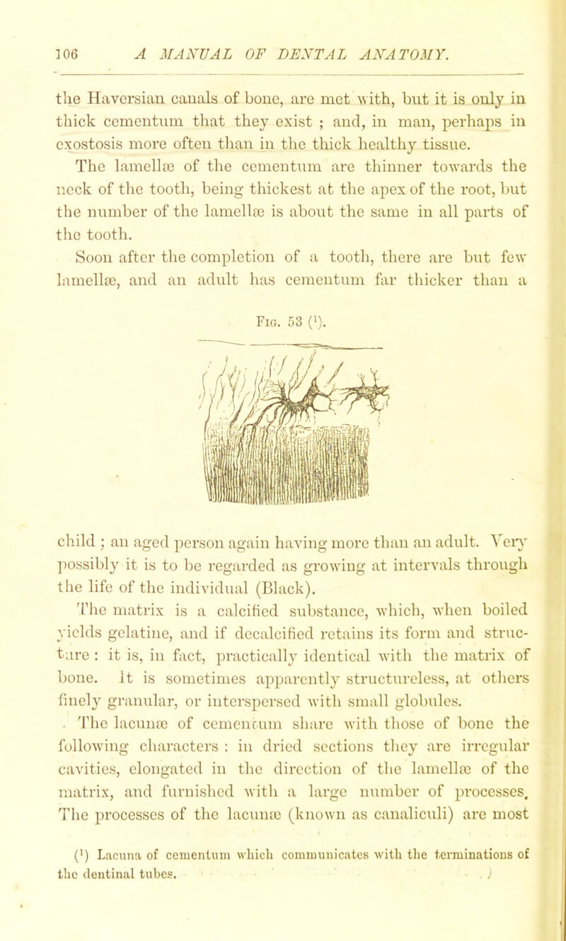 tlie Haversian canals of bone, are met with, but it is only in thick cementum that they exist ; and, in man, perhaps in exostosis more often than in the thick healthy tissue. The lamella) of the cementum are thinner towards the neck of the tooth, being thickest at tlie apex of the root, but the number of the lamellae is about the same in all parts of the tooth. Soon after the completion of a tooth, there are but few lamella), and an adult has cementum far thicker than a Fio. .53 (>). child ; an aged person again having more than an adult. Yen' possibly it is to be regarded as growing at intervals through the life of the individual (Black). 'fhe matrix is a calcified substance, which, when boiled yields gelatine, and if decalcified retains its form and struc- ture : it is, in fact, practically identical with the matrix of bone. It is sometimes apparently structureless, at others finely granular, or interspersed with small globules. . 'I'he lacuna) of cemenrum share with those of bone the followdng characters : in dried sections they are irregular cavities, elongated in the direction of the lamella) of the matrix, and furni.shed with a large number of processes. The processes of the lacuna) (known as canaliculi) arc most (') Lacuna of cementum which communicates with the terminations of the dentinal tubes.