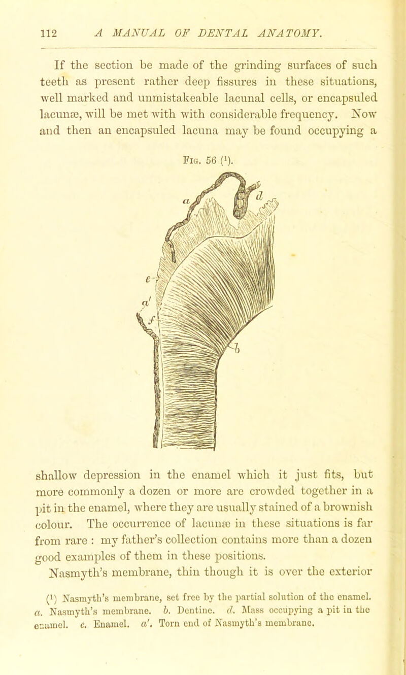 If the section be made of the grinding surfaces of such teeth as present rather deep fissures in these situations, well marked and unmistakeable lacunal cells, or encapsuled lacuiiEB, will he met with with considerable frequency. Kow and then an encapsuled lacuna may be found occupying a Fig. 56 (•). shallow depression in the enamel which it just fits, but more commonly a dozen or more are crowded together in a pit in the enamel, where they are usually stained of a brownish colour. The occurrence of lacume in these situations is far from rare : my fatliei’’s collection contains more than a dozen good examples of them in these positions. Nasmyth’s membrane, thin though it is over the exterior (') N'asmji;h’s membrane, set free by tlie partial solution of tbc enamel. a. Nasmyth’s membrane, h. Dentine, cl. lilass oecupying a pit in the enamel, e. Enamel. Torn end of Nasmyth’s membrane.