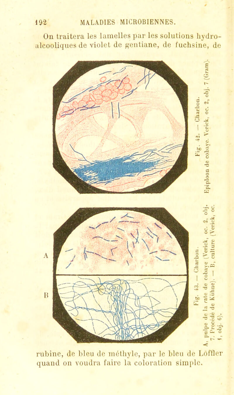 On traitera les lamelles par les solutions hydro- alcooliques de violet de gentiane, de fuchsine, de rubine, de bleu de méthylc, par le bleu de Lôffler quand on voudra faire la coloration simple.