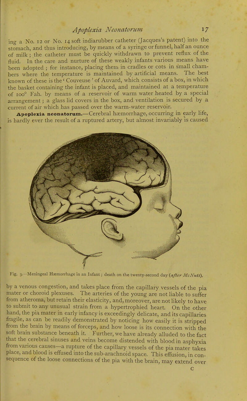 ing a No. 12 or No. 14 soft indiarubber catheter (Jacques’s patent) into the stomach, and thus introducing, by means of a syringe or funnel, half an ounce of milk ; the catheter must be quickly withdrawn to prevent reflux of the fluid. In the care and nurture of these weakly infants various means have been adopted ; for instance, placing them in cradles or cots in small cham- bers where the temperature is maintained by artificial means. The best known of these is thef Couveuse ’ of Auvard, which consists of a box, in which the basket containing the infant is placed, and maintained at a temperature of ioo° Fah. by means of a reservoir of warm water heated by a special arrangement; a glass lid covers in the box, and ventilation is secured by a current of air which has passed over the warm-water reservoir. Apoplexia neonatorum.—Cerebral haemorrhage, occurring in early life, is hardly ever the result of a ruptured artery, but almost invariably is caused Fig. 3. -Meningeal Hemorrhage in an Infant; death on the twenty-second day {after McNutt). by a venous congestion, and takes place from the capillary vessels of the pia mater or choroid plexuses. The arteries of the young are not liable to suffer from atheroma, but retain their elasticity, and, moreover, are not likely to have to submit to any unusual strain from a hypertrophied heart. On the other hand, the pia mater in early infancy is exceedingly delicate, and its capillaries fragile, as can be readily demonstrated by noticing how easily it is stripped from the brain by means of forceps, and how loose is its connection with the soft brain substance beneath it. Further, we have already alluded to the fact that the cerebral sinuses and veins become distended with blood in asphyxia from various causes—a rupture of the capillary vessels of the pia mater takes place, and blood is effused into the sub-arachnoid space. This effusion, in con- sequence of the loose connections of the pia with the brain, may extend over c