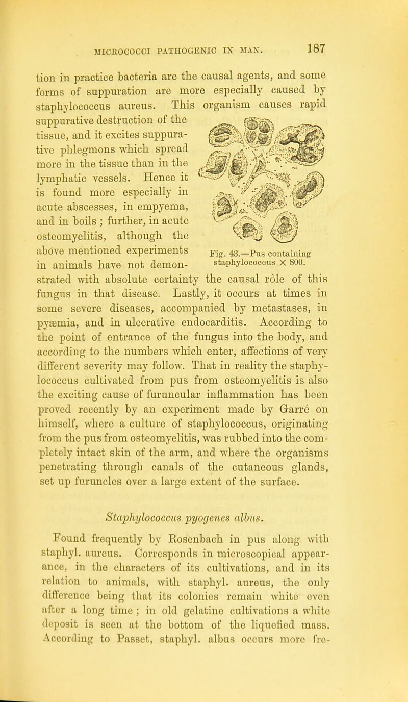 Fig. 43.—Pus containing staxshylococcus X 800. tion in practice bacteria are the causal agents, and some forms of suppm-ation are more especially caused by staphylococcus aureus. This organism causes rapid suppurative destruction of the tissue, and it excites suppura- tive phlegmons which spread more in the tissue than in the lymphatic vessels. Hence it is found more especially in acute abscesses, in empyema, and in boils ; further, in acute osteomyelitis, although the above mentioned experiments in animals have not demon- strated with absolute certainty the causal role of this fungus in that disease. Lastly, it occurs at times in some severe diseases, accompanied by metastases, in pyaemia, and in ulcerative endocarditis. According to the point of entrance of the fungus into the body, and according to the numbers which enter, affections of very different severity may follow. That in reality the staphy- lococcus cultivated from pus from osteomyelitis is also the exciting cause of furuncular inflammation has been proved recently by an experiment made by Garre on himself, where a culture of staphylococcus, originating from the pus from osteomyelitis, was rubbed into the com- pletely intact skin of the arm, and where the organisms penetrating through canals of the cutaneous glands, set up furuncles over a large extent of the surface. Staphylococcus pyogenes alhus. Found frequently by Rosenbach in pus along with staphyl. aureus. Corresponds in microscopical appear- ance, in the characters of its cultivations, and in its relation to animals, with staphyl. aureus, the only difference being that its colonies remain white even after a long time ; in old gelatine cultivations a white deposit is seen at the bottom of the liquefied mass. According to Passet, staphyl. albus occurs more fi-e-