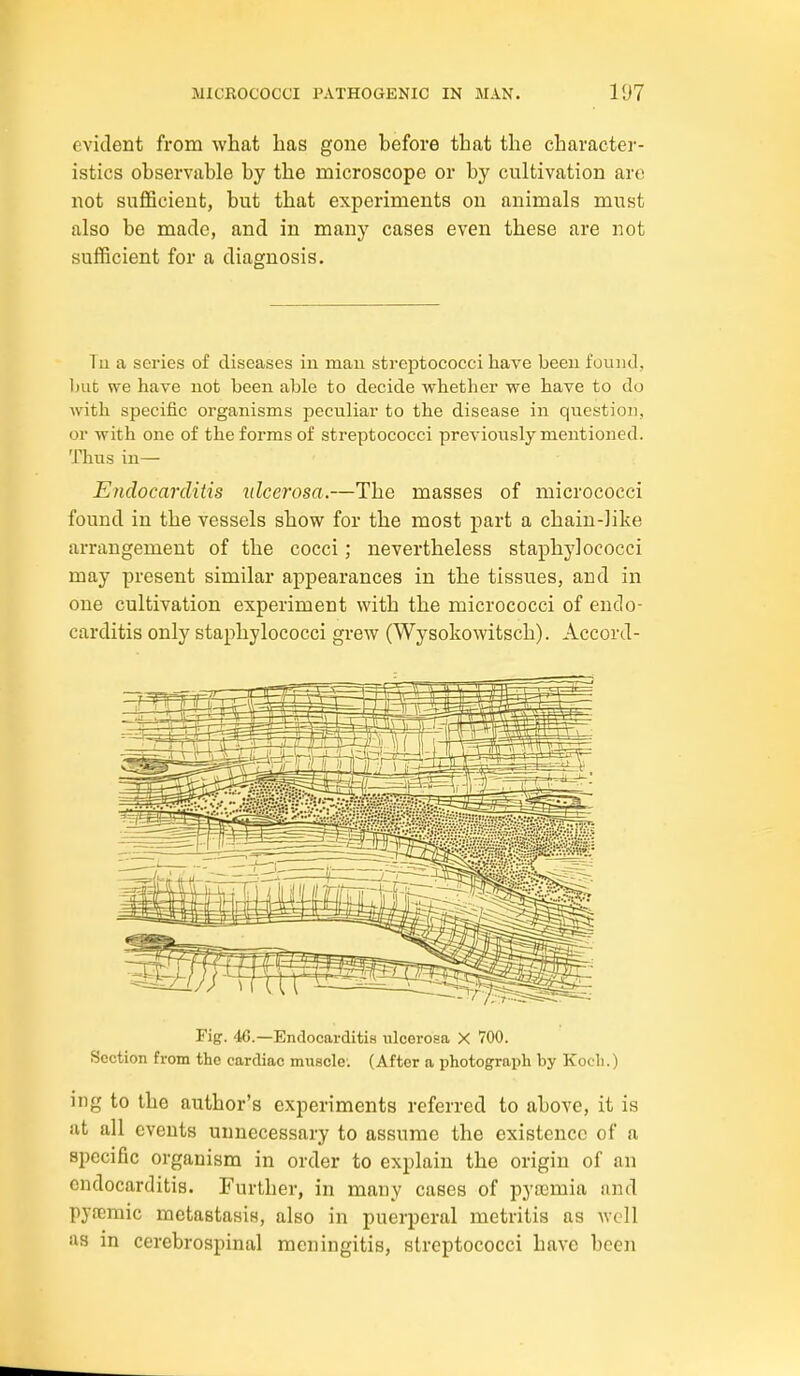 evident from what has gone before that the character- istics observable by the microscope or by cultivation are not sufficient, but that experiments on animals must also be made, and in many cases even these are not sufficient for a diagnosis. Tu a series of diseases iu mau streptococci have been fouiid, but we have not been able to decide whether we have to do with specific organisms peculiar to the disease in question, or with one of the forms of streptococci previously mentioned. Thus in— Endocarditis idcerosa.—The masses of micrococci found in the vessels show for the most part a chain-like arrangement of the cocci; nevertheless staphylococci may present similar appearances in the tissues, and in one cultivation experiment with the micrococci of endo- carditis only staphylococci grew (Wysokowitsch). Accord- Fig. 46.—Endocarditis ulcerosa X 700. Section from the cardiac muscle-. (After a photograph by Koch.) ing to the author's experiments referred to above, it is at all events unnecessary to assume the existence of a specific organism in order to explain the origin of an endocarditis. Further, in many cases of pytemia and pya?mic metastasis, also in puerperal metritis as well as in cerebrospinal meningitis, streptococci have been