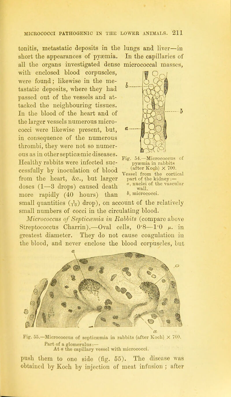 tonitis, metastatic deposits in tlie lungs and liver—in short the appearances of pyaemia. In the capillaries of all the organs investigated dense micrococcal masses, with enclosed hlood corpuscles, were found; likewise in the me- tastatic deposits, where they had passed out of the vessels and at- tacked the neighbouring tissues. In the blood of the heart and of the larger vessels numerous micro- cocci were likewise present, but, in consequence of the numerous thrombi, they were not so numer- ous as in other septicaemic diseases. Healthy rabbits were infected suc- cessfully by inoculation of blood from the heart, &c., but larger doses (1—3 drops) caused death more rapidly (40 hours) than small quantities (tV) drop), on account of the relatively small numbers of cocci in the circulating blood. Micrococcus of Septicmnia in Rabbits (compare above Streptococcus Charrin).—Oval cells, 08—I'O /x. in greatest diameter. They do not cause coagulation in the blood, and never enclose the blood corpuscles, but Fig. 54.—MicrococctiiS of pysemia in rabbits (after Kocli) X 700. Vessel from tlie cortical part of the kidney:— (/, nuclei of the vascular wall. b, micrococci. '^\..„M'li rig. 60.—Micrococcus of sopticoimia in rabbits (after Koch) X 700. Part of a glomerulus:— At a the capillary vessel with micrococci. push them to one side (fig. 55). The disease was obtained by Koch by injection of meat infusion ; after