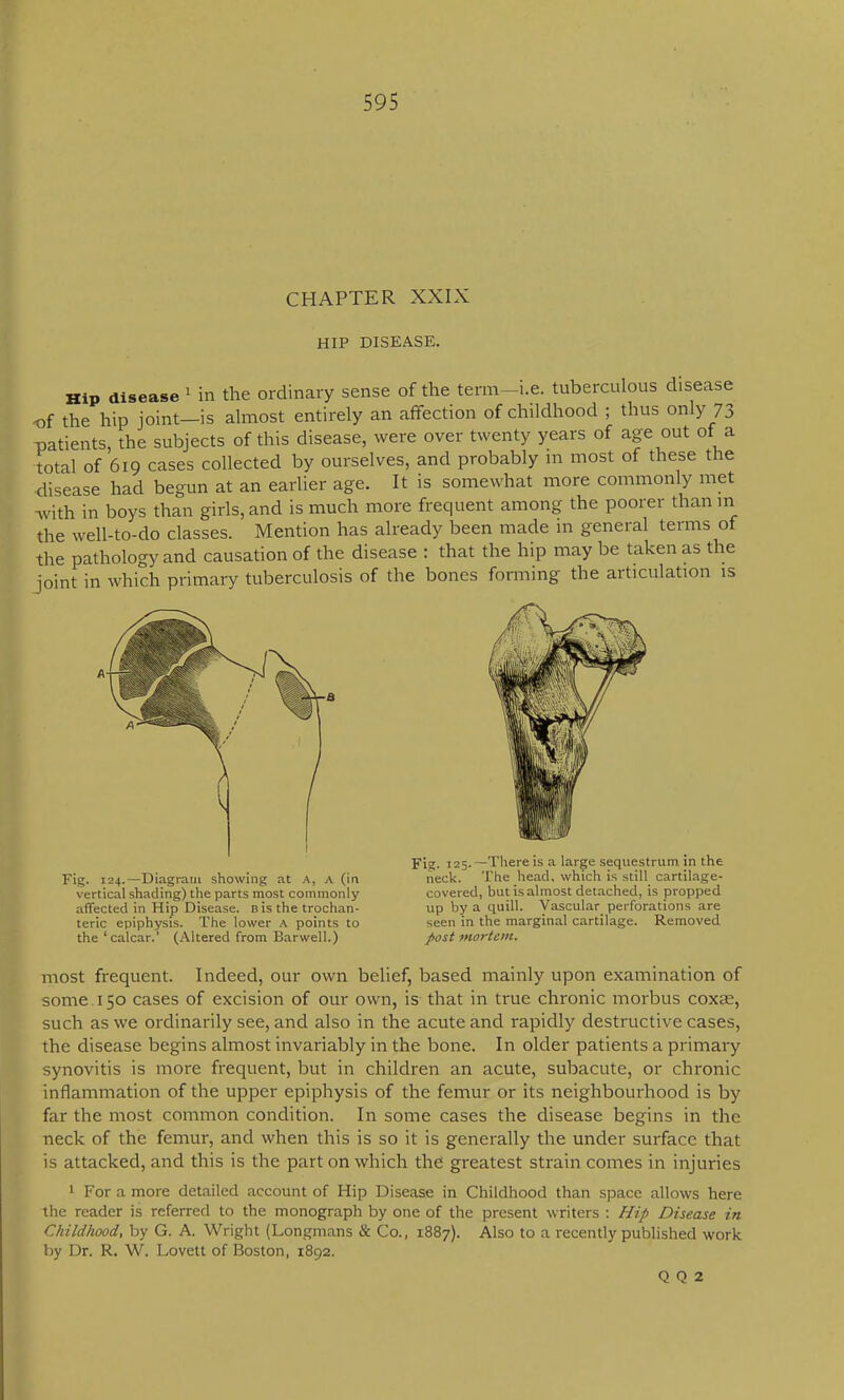 CHAPTER XXIX HIP DISEASE. Hip disease ^ in the ordinary sense of the term—i.e. tuberculous disease -of the hip joint—is almost entirely an affection of childhood ; thus only 73 patients, the subjects of this disease, were over twenty years of age out of a total of 619 cases collected by ourselves, and probably in most of these the disease had begun at an earlier age. It is somewhat more commonly met with in boys than girls, and is much more frequent among the poorer than m the well-to-do classes. Mention has already been made m general terms of the pathology and causation of the disease : that the hip may be taken as the joint in which primary tuberculosis of the bones forming the articulation is most frequent. Indeed, our own belief, based mainly upon examination of some. 150 cases of excision of our own, is that in true chronic morbus coxse, such as we ordinarily see, and also in the acute and rapidly destructive cases, the disease begins almost invariably in the bone. In older patients a primary synovitis is more frequent, but in children an acute, subacute, or chronic inflammation of the upper epiphysis of the femur or its neighbourhood is by far the most common condition. In some cases the disease begins in the neck of the femur, and when this is so it is generally the under surface that is attacked, and this is the part on which the greatest strain comes in injuries 1 For a more detailed account of Hip Disease in Childhood than space allows here the reader is referred to the monograph by one of the present writers : Hip Disease in Childhood, by G. A. Wright (Longmans & Co., 1887). Also to a recently published work by Dr. R. W. Lovett of Boston, 1892. Fig. 124.—Diagram showing at A, A (in vertical shading) the parts most commonly affected in Hip Disease. Bis the trochan- teric epiphysis. The lower A points to the ‘calcar.’ (Altered from Barwell.) Fig. 125.—There is a large sequestrum in the neck. The head, which is still cartilage- covered, but is almost detached, is propped up by a quill. Vascular perforations are seen in the marginal cartilage. Removed post mortem. Q Q 2