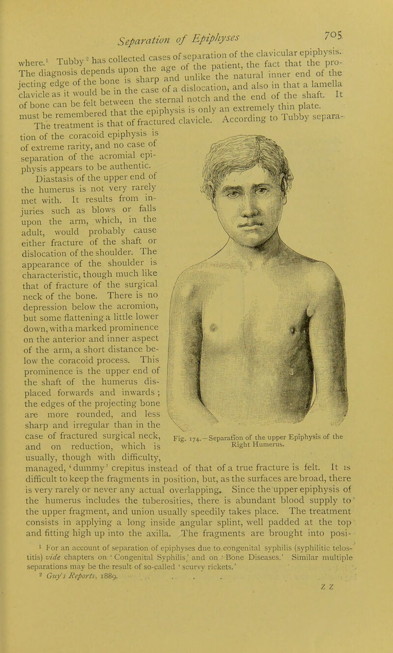 Separation of Epiphyses 7^S. .. 1 iior't'prl r-ises of separation of the clavicular epiphysis. where.' Tubby' has colie ^ ^^1^^^^ patient, the fact that the pro- The diagnosis depends upon^ unHke the natural inner end of the jectmg edge of the bone ^ and also in that a lamella clavicle as sternal notch and the end of the shaft. It of bone can be fc epiphysis is only an extremely thin plate, ““^h^rrent clavicle. According .o Tubby separa- tion of the coracoid epiphysis is of extreme rarity, and no case of separation of the acromial epi- physis appears to be authentic. Diastasis of the upper end of the humerus is not very rarely met with. It results from in- juries such as blows or falls upon the arm, which, in the adult, would probably cause either fracture of the shaft or dislocation of the shoulder. The appearance of the shoulder is characteristic, though much like that of fracture of the surgical neck of the bone. There is no depression below the acromion, but some flattening a little lower down, with a marked prominence on the anterior and inner aspect of the arm, a short distance be- low the coracoid process. This prominence is the upper end of the shaft of the humerus dis- placed forwards and inwards ; the edges of the projecting bone are more rounded, and less sharp and irregular than in the case of fractured surgical neck, and on reduction, which is Fig. 174.—Separation of the upper Epiphysis of the Right Humerus. usually, though with difficulty, managed, ‘dummy’ crepitus instead of that of a true fracture is felt. It is difficult to keep the fragments in position, but, as the surfaces are broad, there is very rarely or never any actual overlapping. Since the upper epiphysis of the humerus includes the tuberosities, there is abundant blood supply to' the upper fragment, and union usually speedily takes place. The treatment consists in applying a long inside angular splint, well padded at the top and fitting high up into the axilla. The fragments are brought into posi- 1 For an account of separation of epiphyses due to congenital syphilis (syphilitic telos- titis) vide chapters on ‘ Congenital Syphilis,’ and on ' Bone Diseases.' Similar multiple separations may be the result of so-called ' scurvy rickets.’ - Guy's Reports, i88g. ....