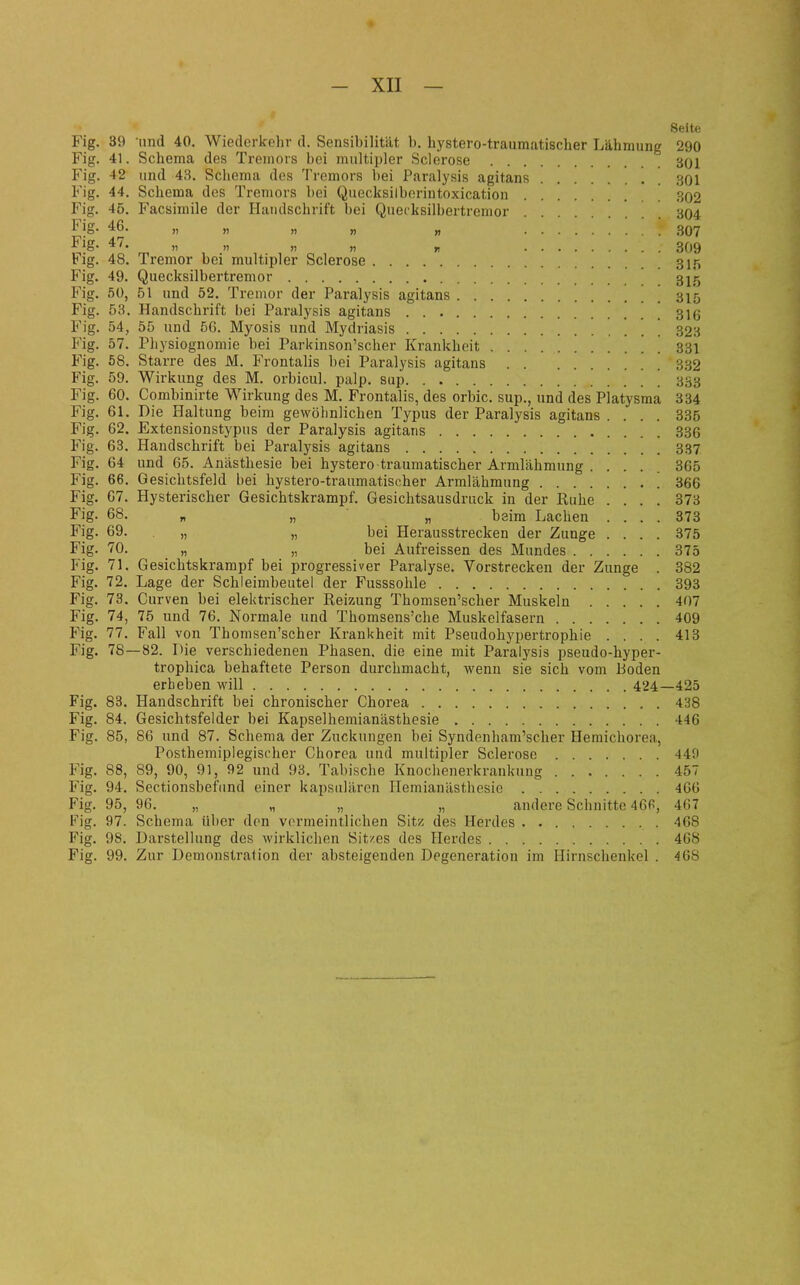 Seite Fig. 39 und 40. Wiederkehr d. Sensibilität b. hystero-traumatischer Lähmung 290 Fig. 41. Schema des Tremors bei multipler Sclerose 301 Fig. 42 und 43. Schema des Tremors bei Paralysis agitans 301 Fig. 44. Schema des Tremors bei Quecksilberintoxication 302 Fig. 45. Facsimile der Handschrift bei Quecksilbertremor 304 Fig. 46. „ „ „ „ „ '.'.['. 307 Fig- 47. „ „ „ „ ^ 3Q9 Fig. 48. Tremor bei multipler Sclerose 3J5 Fig. 49. Quecksilbertremor 3^5 Fig. 50, 51 und 52. Tremor der Paralysis agitans 315 Fig. 53. Handschrift bei Paralysis agitans ] 316 Fig. 54, 55 und 5G. Myosis und Mydriasis  323 Fig. 57. Physiognomie bei Parkinson'scher Krankheit . 331 Fig. 58. Starre des M. Frontalis bei Paralysis agitans 332 Fig. 59. Wirkung des M. orbicul. palp. sup 333 Fig. 60. Combinirte Wirkung des M. Frontalis, des orbic. sup., und des Platysma 334 Fig. 61. Die Haltung beim gewöhnlichen Typus der Paralysis agitans .... 335 Fig. 62. Extensionstypus der Paralysis agitans 336 Fig. 63. Handschrift bei Paralysis agitans 337 Fig. 64 und 65. Anästhesie bei hystero traumatischer Armlähmung ..... 365 Fig. 66. Gesichtsfeld bei hystero-traumatischer Armlähmung 366 Fig. 67. Hysterischer Gesichtskrampf. Gesichtsausdruck in der Ruhe .... 373 Fig- 68. „ „ „ beim Lachen .... 373 Fig. 69. „ „ bei Herausstrecken der Zunge .... 375 Fig. 70. „ „ bei Aufreissen des Mundes 375 Fig. 71. Gesichtskrampf bei progressiver Paralyse. Vorstrecken der Zunge . 382 Fig. 72, Lage der Schleimbeutel der Fusssohle 393 Fig. 73. Curven bei elektrischer Reizung Thomsen'scher Muskeln 407 Fig. 74, 75 und 76. Normale und Thomsens'che Muskelfasern 409 Fig. 77. Fall von Thomsen'scher Krankheit mit Pseudohypertrophie .... 413 Fig. 78—82. Tie verschiedenen Phasen, die eine mit Paralysis pseudo-hyper- trophica behaftete Person durchmacht, wenn sie sich vom Boden erheben will 424—425 Fig. 83. Handschrift bei chronischer Chorea 438 Fig. 84. Gesichtsfelder bei Kapseihemianästhesie 446 Fig. 85, 86 und 87. Schema der Zuckungen bei Syndenham'scher Hemichorea, Posthemiplegischer Chorea und multipler Sclerose 440 Fig. 88, 89, 90, 91, 92 und 93. Tabische Knochenerkrankung 457 Fig. 94. Sectionsbefiind einer kapsulären Hemianästhesie 466 Fig. 95, 96. „ „ „ „ andere Schnitte 46fi, 467 Fig. 97. Schema über den vermeintlichen Sitz des Herdes 468 Fig. 98. Darstellung des wirklichen Sitzes des Herdes 468 Fig. 99. Zur Demonstration der absteigenden Degeneration im Hirnschenkel . 468