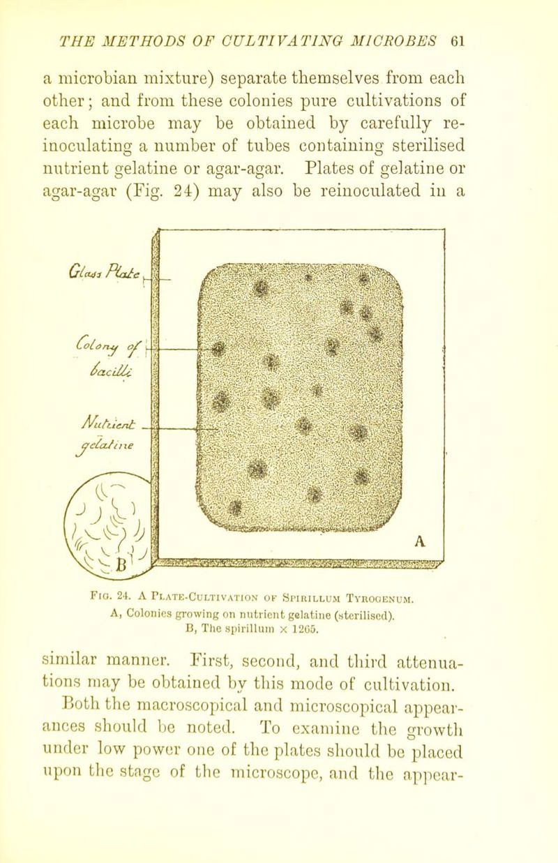 a microbial! mixture) separate themselves from each other; and from these colonies pure cultivations of each microbe may be obtained by carefully re- inoculating a number of tubes containing sterilised nutrient gelatine or agar-agar. Plates of gelatine or agar-agar (Fig. 24) may also be reinoculated in a Fio. 24. A Plate-Cultivation ov SrnuLLU.M Tyuooenum. A, Colonies growing on nutrient gelatine (sterilised). B, The spirillum x 1205. similar manner. First, second, and third attenua- tions may be obtained by this mode of cultivation. Both the macroscopical and microscopical appear- ances should be noted. To examine the growth under low power one of the plates should be placed upon the stage of the microscope, and the appear-