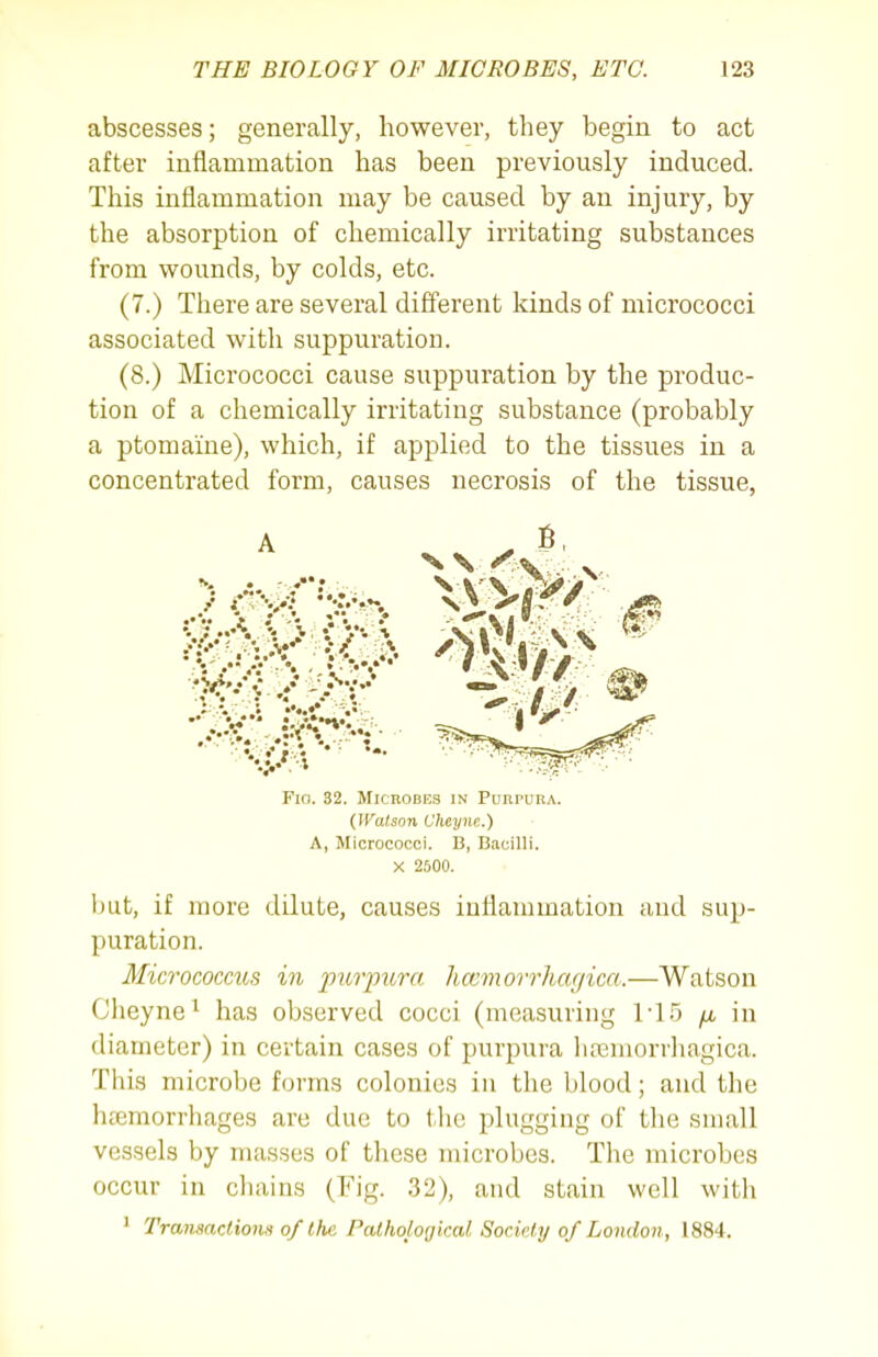abscesses; generally, however, they begin to act after inflammation has been previously induced. This inflammation may be caused by an injury, by the absorption of chemically irritating substances from wounds, by colds, etc. (7.) There are several different kinds of micrococci associated with suppuration. (8.) Micrococci cause suppuration by the produc- tion of a chemically irritating substance (probably a ptomaine), which, if applied to the tissues in a concentrated form, causes necrosis of the tissue, A ✓ ^' N S ^ Fio. 32. MicnoDEs in PunruRA. QValsnn Cheyne.) A, Micrococci. B, Bacilli. X 2,500. but, if more dilute, causes inflammation and sup- puration. Micrococcus in pitrpura liccmorrhagica.—Watson Cheyne^ has observed cocci (measuring ri5 jx in diameter) in certain cases of purpura liremorrhagica. This microbe forms colonies in the blood; and the htemorrhages arc due to the plugging of the small vessels by masses of these microbes. The microbes occur in chains (Fig. 32), and stain well with * Transactions of the Pathological Socidy of London, 1884.