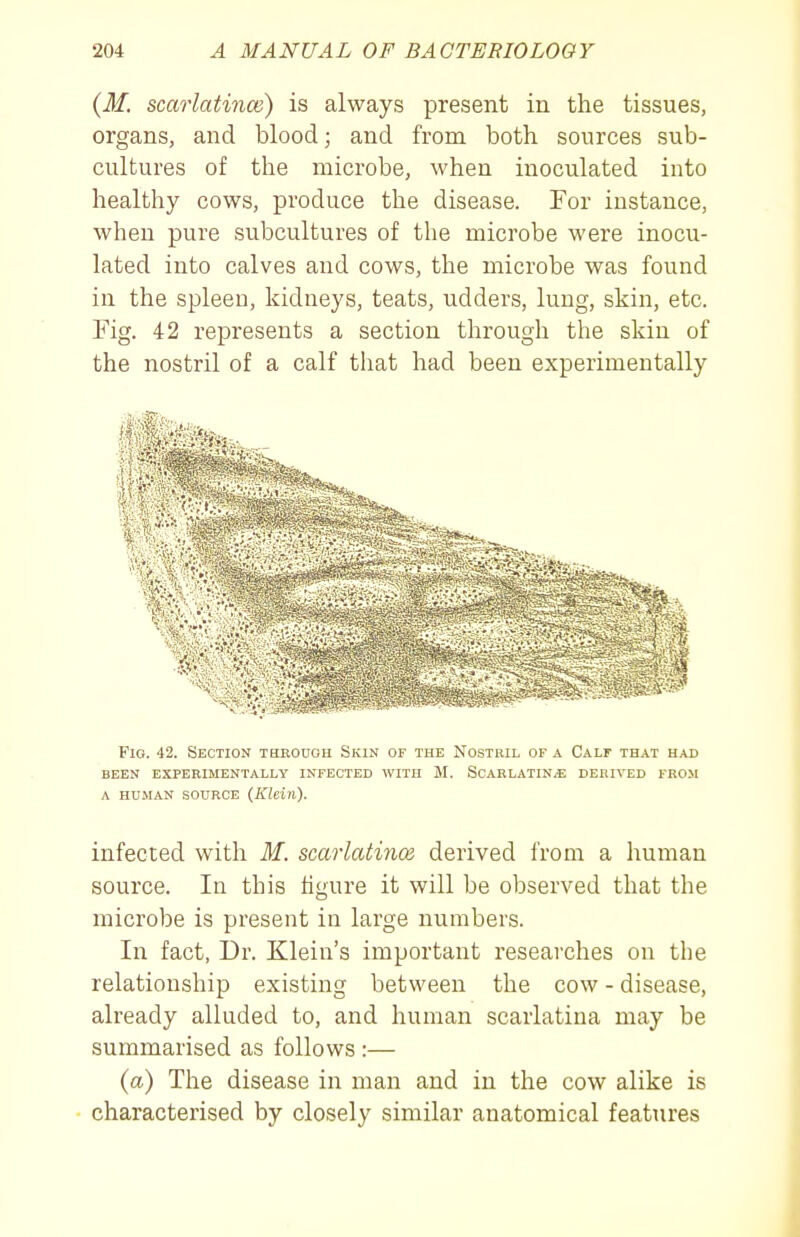 {M. scarlatince) is always present in the tissues, organs, and blood; and from both sources sub- cultures of the microbe, when inoculated iuto healthy cows, produce the disease. For instance, when pure subcultures of the microbe were inocu- lated into calves and cows, the microbe was found in the spleen, kidneys, teats, udders, lung, skin, etc. Fig. 42 represents a section through the skin of the nostril of a calf that had been experimentally Fio. 42. Section throuoh Skin of the Nostril of a Calf that had BEEN EXPERIMENTALLY INFECTED WITH M. SCARLATINA DERIVED FROM A HUMAN SOURCE (Klein). infected with M. scarlatince derived from a human source. In this iigure it will be observed that the microbe is present in large numbers. In fact, Dr. Klein's important researches on the relationship existing between the cow - disease, already alluded to, and human scarlatina may be summarised as follows :— (a) The disease in man and in the cow alike is characterised by closely similar anatomical features