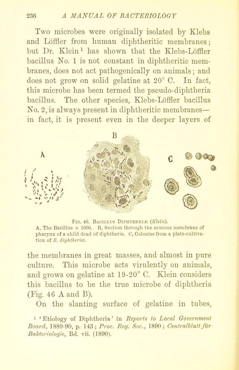 Two microbes were originally isolated by Klebs and Loffler from human diphtheritic membranes; but Dr. Klein ^ has shown that the Klebs-Loffler bacillus No. 1 is not constant in diphtheritic mem- branes, does not act pathogenically on animals; and does not grow on solid gelatine at 20° C. In fact, this microbe has been termed the pseudo-diphtheria bacillus. The other species, Klebs-Loffler bacillus No. 2, is always present in diphtheritic membranes— in fact, it is present even in the deeper layers of Fio. 46. Bacillus Diphtheria (Klein). A, The Bacillus x 1000. B, Section through the mucous membrane of pharynx of a child dead of diphtheria. C, Colonies from a plate-cultiva- tion of jS. cliphtherice. the membranes in great masses, and almost in pure culture. This microbe acts virulently on animals, and grows on gelatine at 19-20° C. Klein considers this bacillus to be the true microbe of diphtheria (Fig. 46 A and B). On the slanting surface of gelatine in tubes, 1 'Etiology of Diphtheria' in Reports to Local Government Board, 1889-90, p. 143; Proc. Rotj. Soc, 1890; CeJitralblait fiir Bakteriologie, Bd. vii. (1890).
