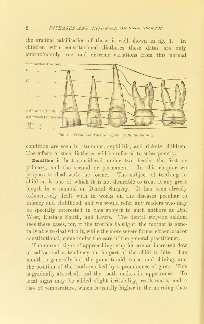 the gradual calcification of these is well shown in fig. 1. In children with constitutional diatheses these dates are only approximately true, and extreme variations from this normal condition are seen in strumous, syphilitic, and rickety children. The effects of such diatheses will be referred to subsequently. Dentition is best considered under two heads—the first or primary, and the second or permanent. In this chapter we propose to deal with the former. The subject of teething in children is one of which it is not desirable to treat at any great length in a manual on Dental Surgery. It has been already exhaustively dealt with in works on the diseases peculiar to infancy and childhood, and we would refer any readers who may be specially interested in this subject to such authors as Drs. West, Eustace Smith, and Lewis. The dental surgeon seldom sees these cases, for, if the trouble be slight, the mother is gene- rally able to deal with it, while the more severe forms, either local or constitutional, come under the care of the general practitioner. The normal signs of approaching eruption are an increased flow of saliva and a tendency on the part of the child to bite. The mouth is generally hot, the gums tumid, tense, and shining, and the position of the tooth marked by a prominence of gum. This is gradually absorbed, and the tooth makes its appearance. To local signs may be added slight irritability, restlessness, and a rise of temperature, which is usually higher in the morning than